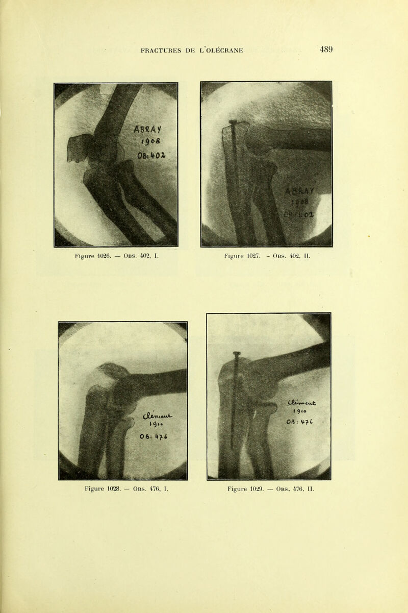 Figure 1028. — Obs. 476, I. Figure 1029. — Obs. 476. II.