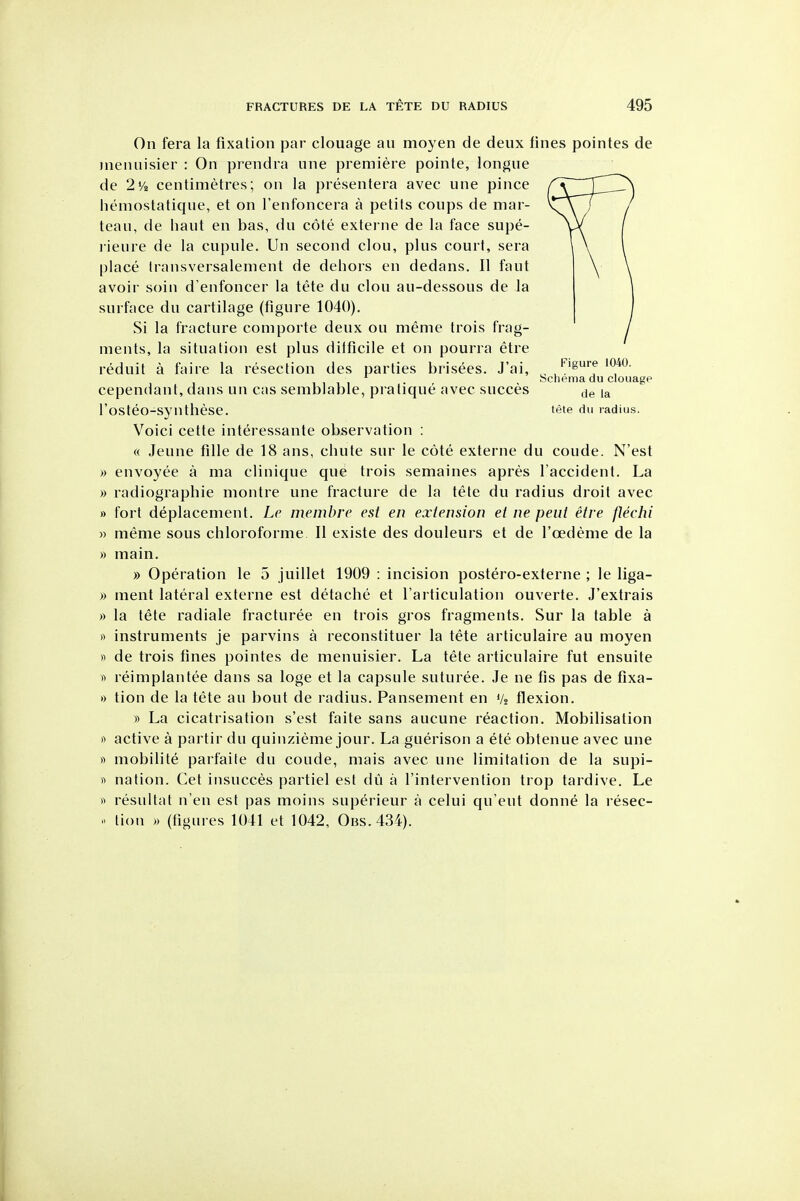 On fera la fixation par clouage au moyen de deux fines pointes de jnenuisier : On prendra une premiere pointe, longne de IVi centimetres; on la presentera avec une pince hemostatique, et on Tenfoncera a petits coups de mar- teau, de liaut en bas, du cote extei ne de la face supe- rieure de la cupule. Un second clou, plus court, sera place transversalement de dehors en dedans. II faut avoir soin d'enfoncer la tete du clou au-dessous de la surface du cartilage (figure 1040). Si la fracture comporte deux ou meme trois frag- ments, la situation est plus difficile et on pourra etre reduit a faire la resection des parties brisees. J'ai, , . , , ^ bcnema du clouagp cependant, dans un cas semblable, pratique avec succes la I'osteO-synthese. tete du radius. Voici cette interessante observation : « Jeune fille de 18 ans, chute sur le cote externe du coude. N'est » envoyee a ma clinique que trois semaines apres I'accident. La » radiographic montre une fracture de la tete du radius droit avec » fort deplacement. Le membre est en extension et ne pent etre flechi » meme sous chloroforme II existe des douleurs et de I'oedeme de la » main. » Operation le 5 juillet 1909 : incision postero-externe ; le liga- )) ment lateral externe est detache et rarticulation ouverte. J'extrais » la tete radiate fracturee en trois gros fragments. Sur la table a instruments je parvins a reconstituer la tete articulaire au moyen « de trois fines pointes de menuisier. La tete articulaire fut ensuite « reimplantee dans sa loge et la capsule suturee. Je ne fis pas de fixa- » tion de la tete au bout de radius. Pansement en Vs flexion. » La cicatrisation s'est faite sans aucune reaction. Mobilisation f> active a partir du quinzieme jour. La guerison a ete obtenue avec une ft mobilite parfaile du coude, mais avec une limitation de la supi- nation. Get iiisucces partiel est du a I'intervention trop tardive. Le « resultat n'en est pas moins superieur a celui qu'eut donne la resec- lion » (figures 1041 et 1042, Obs.434).