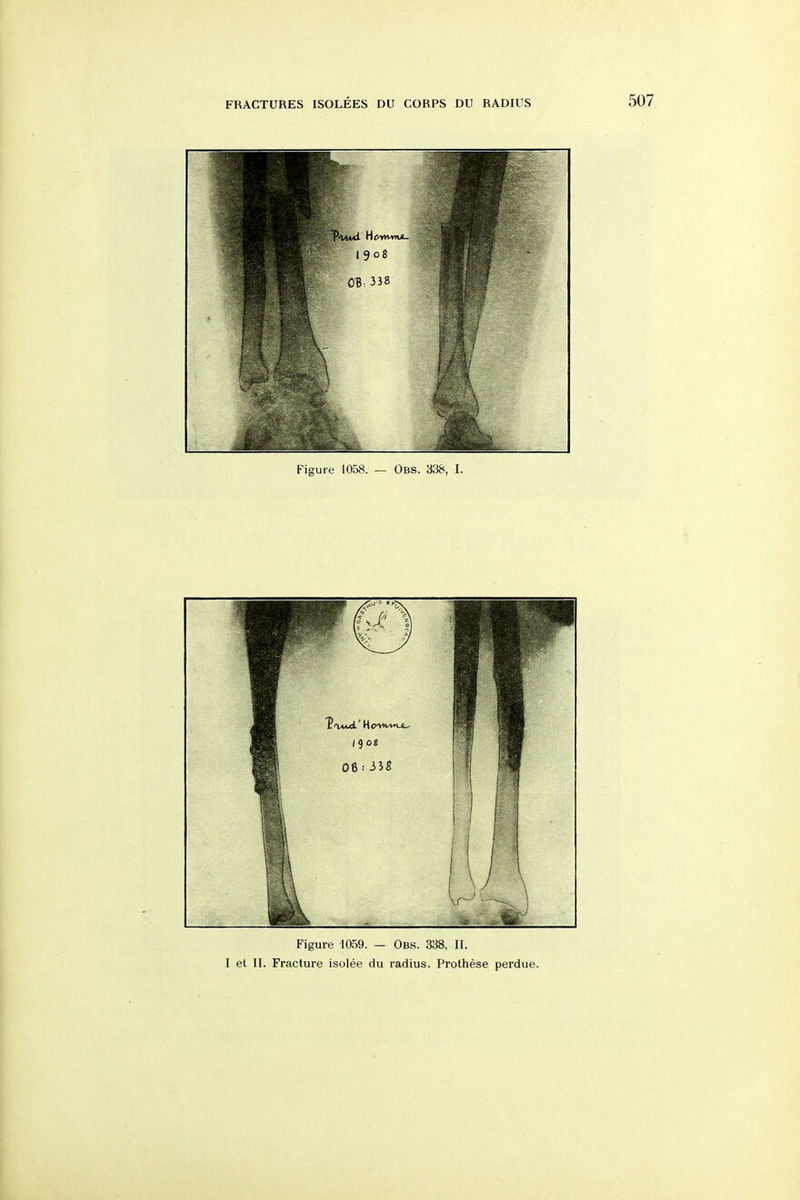 Figure 1058. — Obs. 338, I. Figure 1059. — Obs. 338, II.