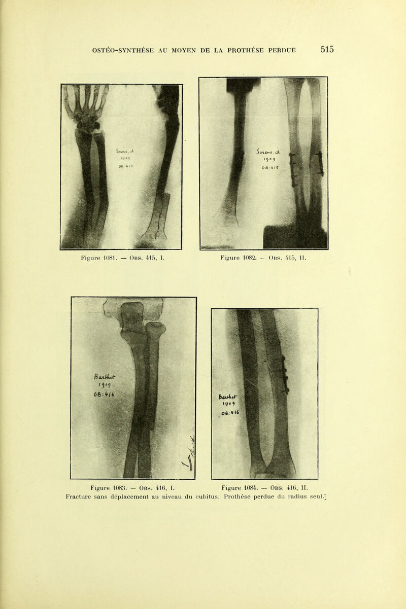 Figure 1083. - Obs. 416, I. Figure 1084. — Obs. 416, II. Fracture sans deplacement au niveau du cubitus. Protiiese perdue du radius seul.5