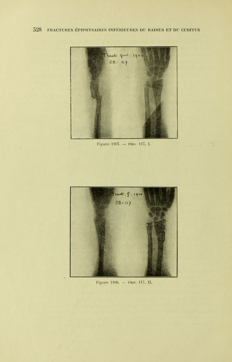 I'igiire 1107. — Obs. 117, ). Figure 1108. — Obs. 117. II.