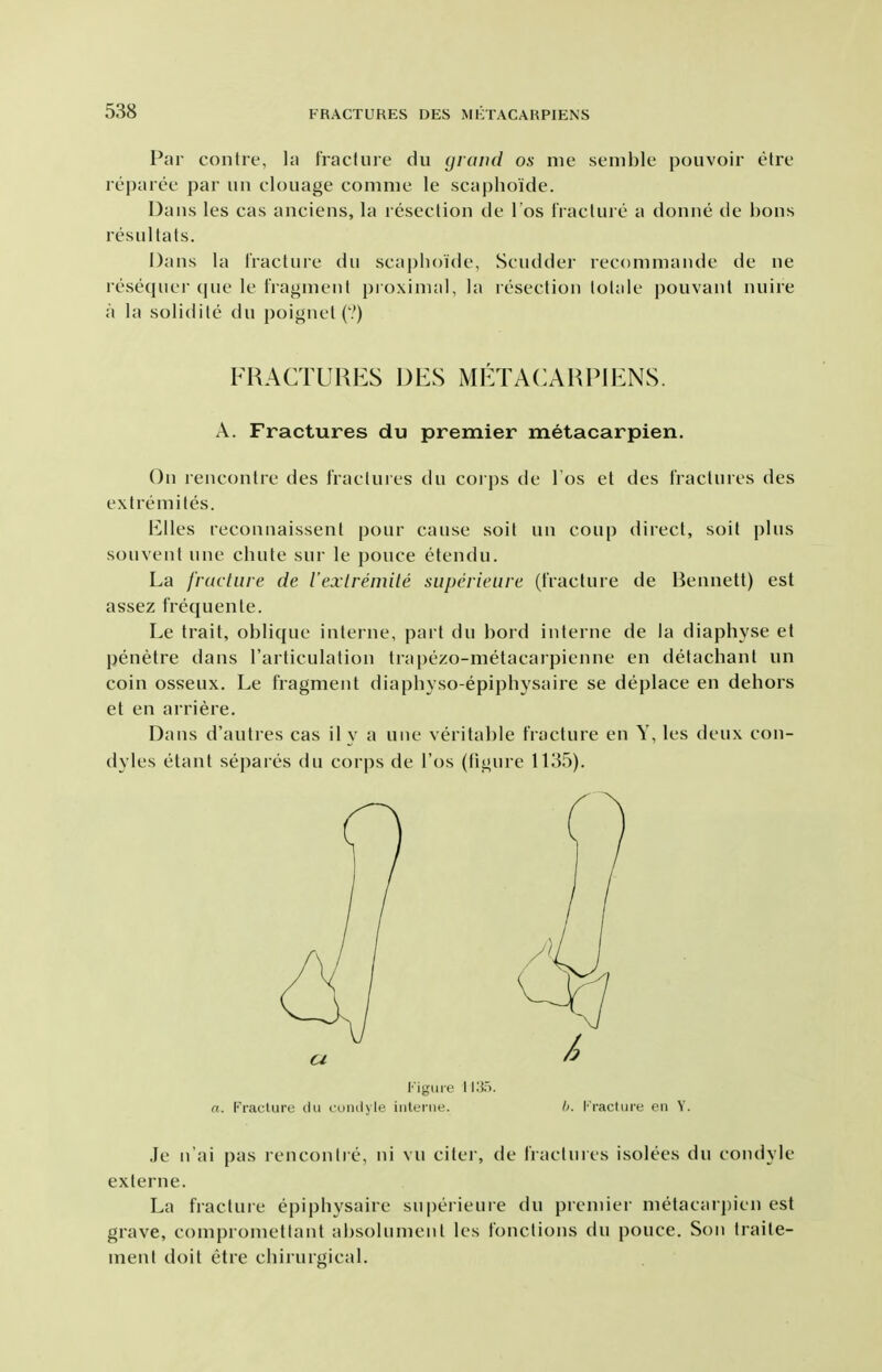 Par contre, la fracture du (jiaiid os me senihle pouvoir elre reparee par un clouage conime le scaphoide. Uaiis les cas anciens, la resection de I'os Fracture a donne de hons resultats. Dans la fracture du scaphoide, Scudder recommande de ne resequer que le fragment pi oximal, la resection tolale pouvant nuire a la solidite du poignet (V) FRACTURES DES METACARPIENS. A. Fractures du premier metacarpien. On rencontre des fractures du coi ps de Tos el des fractures des extremites. Elles reconnaissent pour cause soit un coup direct, soit plus souvenl une chute sur le pouce etendu. La fracture de iexlremile superieiire (fracture de Bennett) est assez frequente. Le trait, oblique interne, part du hord interne de la diaphyse et penetre dans I'articulation trapezo-metacarpienne en delachant un coin osseux. Le fragment diaphyso-epiphysaire se deplace en dehors et en arriere. Dans d'autres cas ily a une veritable fracture en Y, les deux con- dyles etant separes du corps de I'os (tigure 1185). I'igiiie 113). a. rraclure clii coiiilyle interne. h. I'racture en Y. Je n'ai pas rencontre, ni vu citer, de fractures isolees du condyle externe. La fracture epiphysaire su|)erieuie du premier metacarpien est grave, compromettant absolumenl les fonclions du pouce. Son traile- ment doit etre chirurgical.