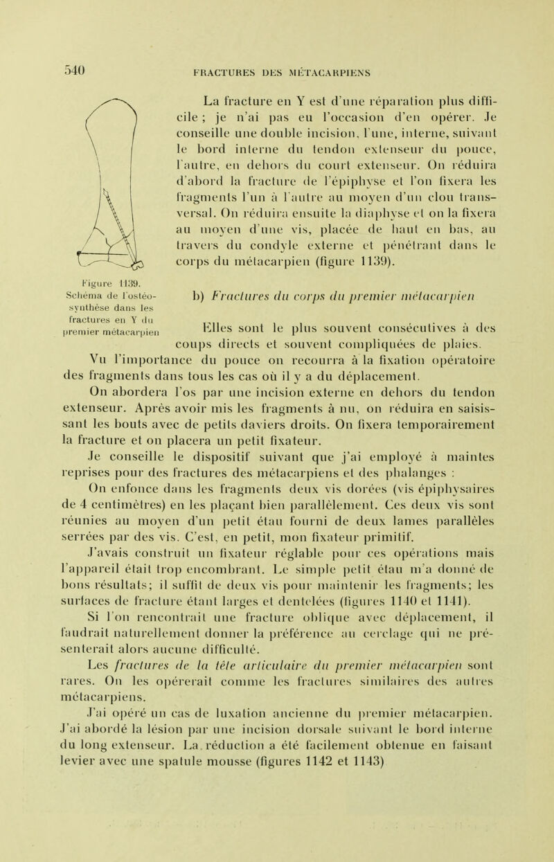 La fracture en Y est d'une reparation plus ditti- cile ; je n'ai pas eu I'occasion d'en operer. Je conseille une double incision. Tune, interne, suivant le bord inlerne dn tendon exlenseur du pouce, I'autre, en deliors du court extenseur. On rednira d'abord la tVacUire de I'epipbyse et Ton fixera les Iragnients I'un a l auUe au nioyen d'un clou trans- versal. On reduira ensuite In diapliyse el on la fixera au nioyen d'une vis, placee de haul en bas, au travers du condyle externe et pencMrant dans le corps du metacarpien (figure 1139). b) F^racliires da corps dn premicf meiaciiipieii Kites sont le plus souvent conseculives a des coups directs et souvent conipliquees de j)laies. Vu I'iniportance du pouce on recourra a la fixation operatoire des fragmenls dans tons les cas ou il y a du deplacemenl. On abordera I'os par une incision externe en dehors du tendon extenseur. Apres avoir mis les fragments a nu, on reduira en saisis- sant les bouts avec de petils daviers droits. On iixera lemporairement la fracture et on placera un petit fixateur. Je conseille le dispositif suivant que j'ai employe a maintes reprises pour des fractures des metacarpiens el des |)halanges : On enfonce dans les fragmenls deux vis dorees (vis epiplnsaires de 4 centimetres) en les plagant bien parallelemenl. Ces deux vis sont reunies au moyen d'un petit etau fourni de deux lames paralleles serrees par des vis. C'est, en petit, mon fixateur primitif. J'avais construit un fixateur reglable pour ces opeialions mais I'appareil clait hop encombrant. Le sim|)le petit etau m a donne de bons resultats; il suffil de deux vis pour mainlenir les IVagments; les surfaces de fraclure etanl larges el denlclees (figures 1140 el 1141). Si I on renconlrail une fracture obliciiie avec deplacemenl, il landrail nalurellenienl donner la prefeience au cerclage (pii ne |)re- senferail alors aucune difficulle. Les fractures de la tele arliculaire du premier melaau pieu son I rares. On les opererail conune les tVacUires siniiliiires des juilies metacarpiens. .T'ai opere un cas de luxation ancienne du premier melacai pien. J'ai aborde la lesion pai' une incision dorsale suivanl le bord inlei ne du long extenseur. La reduclion a ele facilement oblenue en I'aisanl levier avec une spalule mousse (figures 1142 et 1143) Figure 1139. Scliema de I'osteo- syiithese dans les IVactuies eii Y du premier metacarpieu