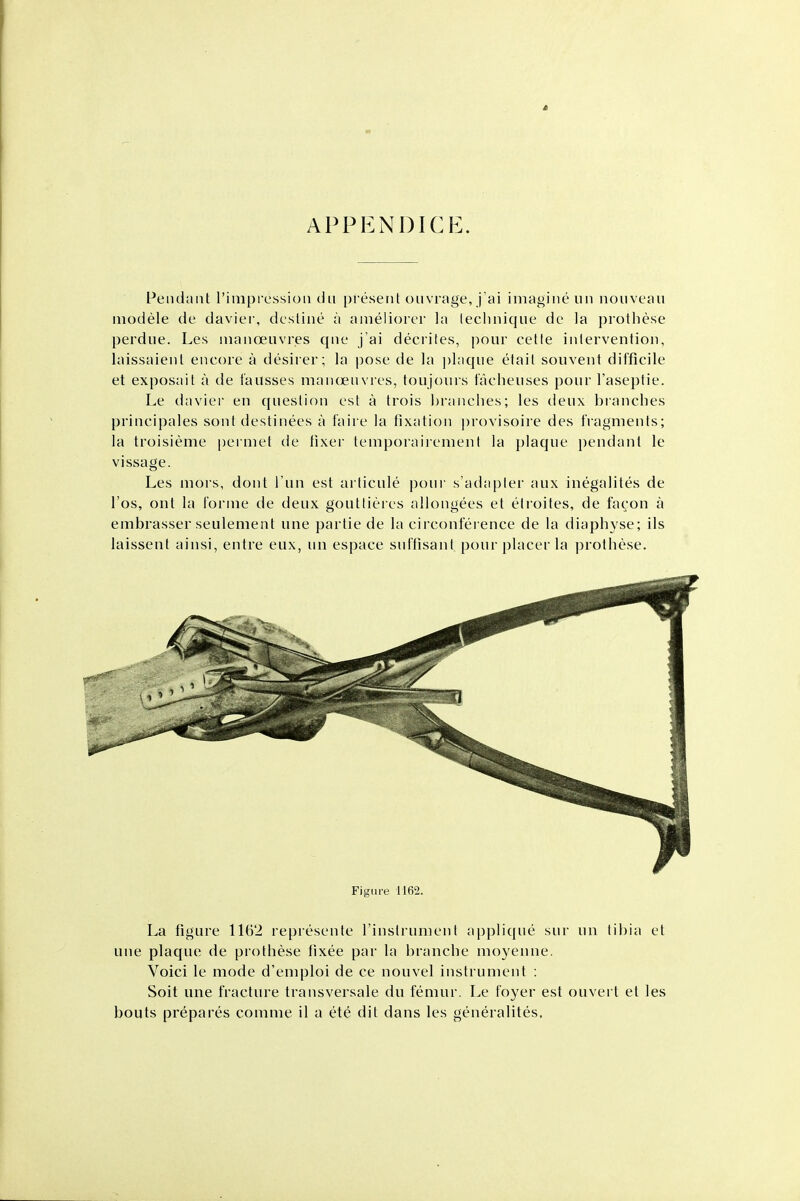 APPENDICE. Pendant I'impression du present ouvrage, j'ai imagine un nonveau niodele de davier, destine a anieliorer la leclmique de la piothese perdue. Les inanoenvres que j'ai decriles, pour cette intervention, laissaienl encore a desirer; la pose de la ])hique etail souvent difficile et exposalt a de fausses manoeuvres, toujours facheuses pour I'aseptie. Le davier en question est a trois branches; les deux bianches principales sont destinees a faire la fixation provisoire des fragments; la troisieme permet de fixer temporairement la plaque pendant le vissage. Les mors, dont Tun est articule pour s'adapler aux inegalites de I'os, ont la forme de deux gouttieres allongees et etroites, de facon a embrasser seulement une partie de la circonference de la diaph3'se; ils laissent ainsi, entre eux, un espace snffisant pour placer la protliese. Figure 1162. La figure 1162 represente I'inslrumenI a|)plique sur un tibia et une plaque de prothese fixee par la branche moyenne. Voici le mode d'emploi de ce nouvel instrument : Soil une fracture transversale du femur, he foyer est ouvert et les bouts prepares comme il a ete dit dans les generalites.