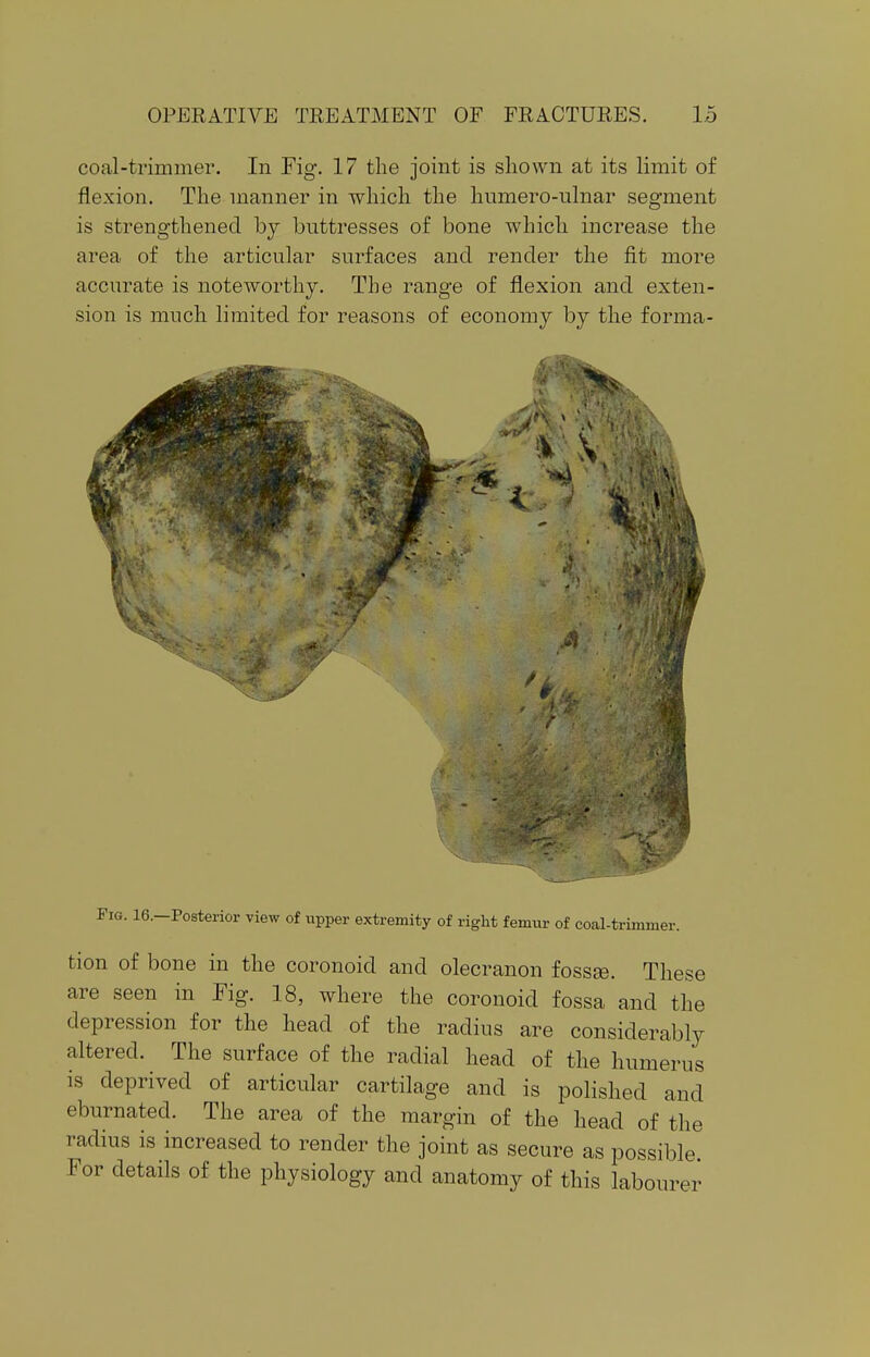 coal-trimmer. In Fig. 17 the joint is shown at its limit of flexion. The manner in which the humero-nlnar segment is strengthened by buttresses of bone which increase the area of the articular surfaces and render the fit more accurate is noteworthy. The range of flexion and exten- sion is much limited for reasons of economy by the forma- Fig. 16.—Posterior view of upper extremity of right femur of coal-trimmer. tion of bone in the coronoid and olecranon fossse. These are seen in Fig. 18, where the coronoid fossa and the depression for the head of the radius are considerably altered. The surface of the radial head of the humerus is deprived of articular cartilage and is polished and eburnated. The area of the margin of the head of the radius is increased to render the joint as secure as possible. For details of the physiology and anatomy of this labourer