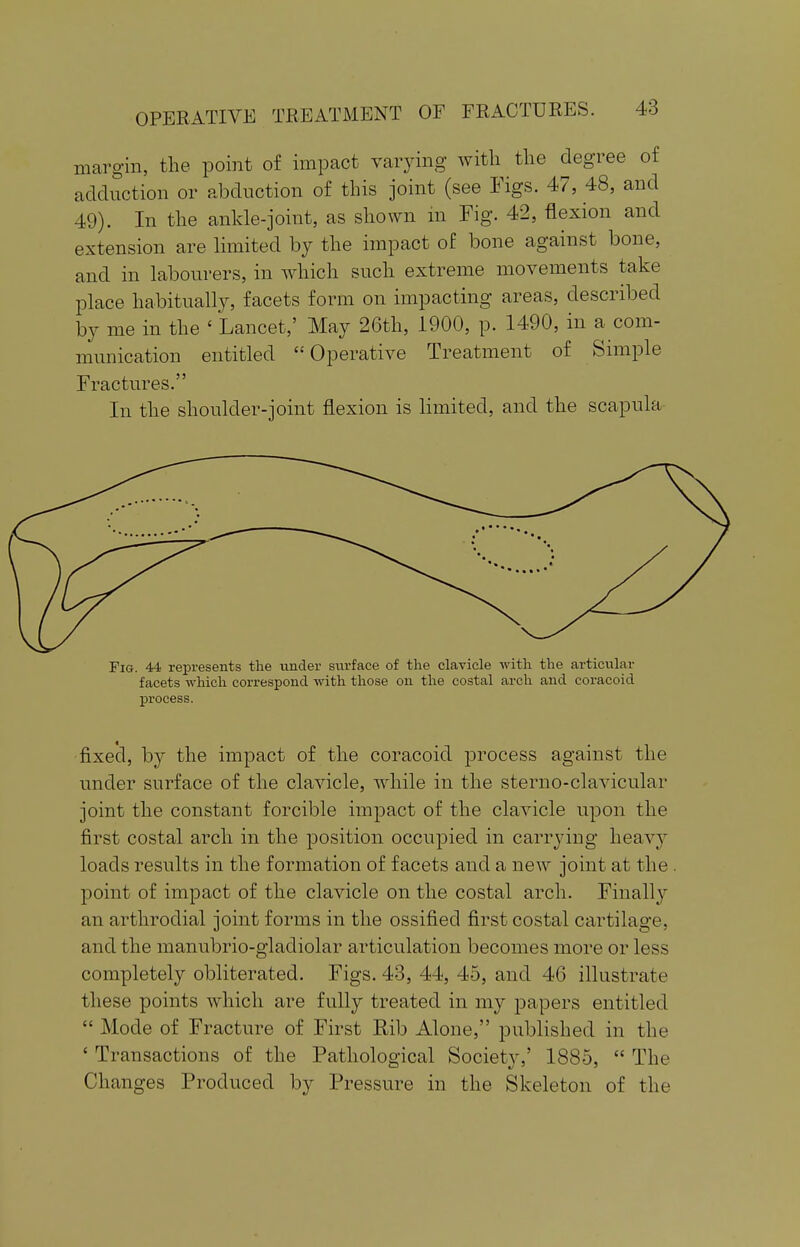 margin, the point of impact varying with the degree of adduction or abduction of this joint (see Figs. 47, 48, and 49). In the ankle-joint, as shown in Fig. 42, flexion and extension are limited by the impact of bone against bone, and in labourers, in which such extreme movements take place habitually, facets form on impacting areas, described by me in the ' Lancet,' May 26th, 1900, p. 1490, in a com- munication entitled Operative Treatment of Simple Fractures. In the shoulder-joint flexion is limited, and the scapula Fig. 44 represents the under surface of the clavicle with the articular facets which correspond with those on the costal arch and coracoid process. fixed, by the impact of the coracoid process against the under surface of the clavicle, while in the sterno-clavicular joint the constant forcible impact of the clavicle upon the first costal arch in the position occupied in carrying heavy loads results in the formation of facets and a new joint at the . point of impact of the clavicle on the costal arch. Finally an arthrodial joint forms in the ossified first costal cartilage, and the manubrio-gladiolar articulation becomes more or less completely obliterated. Figs. 43, 44, 45, and 46 illustrate these points which are fully treated in my papers entitled  Mode of Fracture of First Rib Alone, published in the ' Transactions of the Pathological Society,' 1885,  The Changes Produced by Pressure in the Skeleton of the