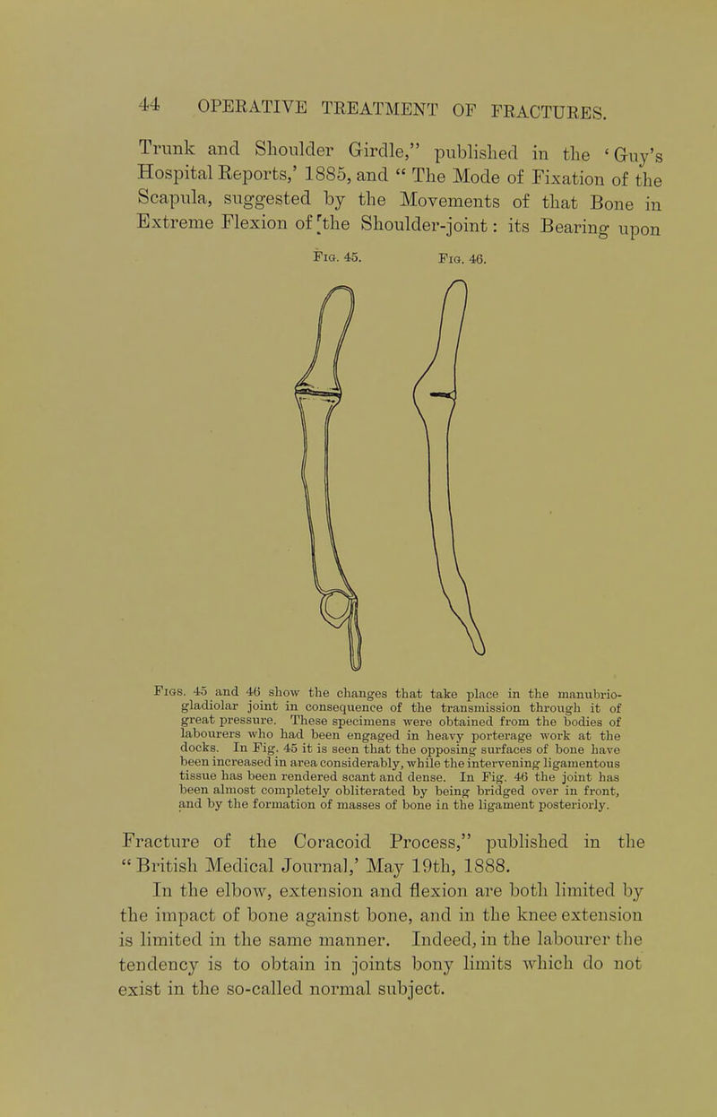 Trunk and Shoulder Girdle, published in the 'Guy's Hospital Reports,' 1885, and  The Mode of Fixation of the Scapula, suggested by the Movements of that Bone in Extreme Flexion of [the Shoulder-joint: its Bearing upon Pig. 45. Fig. 46. Figs. 45 and 4(3 show the changes that take place in the manubrio- gladiolar joint in conseqiience of the transmission through it of great pressure. These specimens were obtained from the bodies of labourers who had been engaged in heavy porterage work at the docks. In Fig. 45 it is seen that the opposing surfaces of bone have been increased in area considerably, while the intervening ligamentous tissue has been rendered scant and dense. In Fig. 46 the joint has been almost completely obliterated by being bridged over in front, and by the formation of masses of bone in the ligament posteriorly. Fracture of the Coracoid Process, published in the British Medical Journal,' May 19th, 1888. In the elbow, extension and flexion are both limited by the impact of bone against bone, and in the knee extension is limited in the same manner. Indeed, in the labourer the tendency is to obtain in joints bony limits which do not exist in the so-called normal subject.