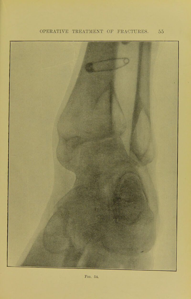 Fig. 54.