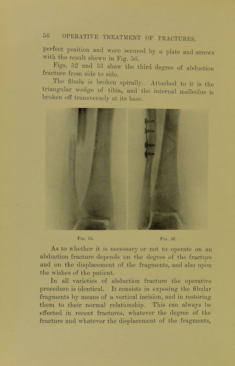 perfect position and were secured by a plate and screws with the result shown in Fig. 56. Pigs. 52 and 53 show the third degree of abduction fracture from side to side. The fibula is broken spirally. Attached to it is the triangular wedge of tibia, and the internal malleolus is broken off transversely at its base. As to whether it is necessary or not to operate on an abduction fracture de]3ends on the degree of the fracture and on the displacement of the fragments, and also upon the wishes of the patient. In all varieties of abduction fracture the operative procedure is identical. It consists in exposing the fibular fragments by means of a vertical incision, and in restoring them to their normal relationship. This can always be effected in recent fractures, whatever the degree of the fracture and whatever the displacement of the fragments,