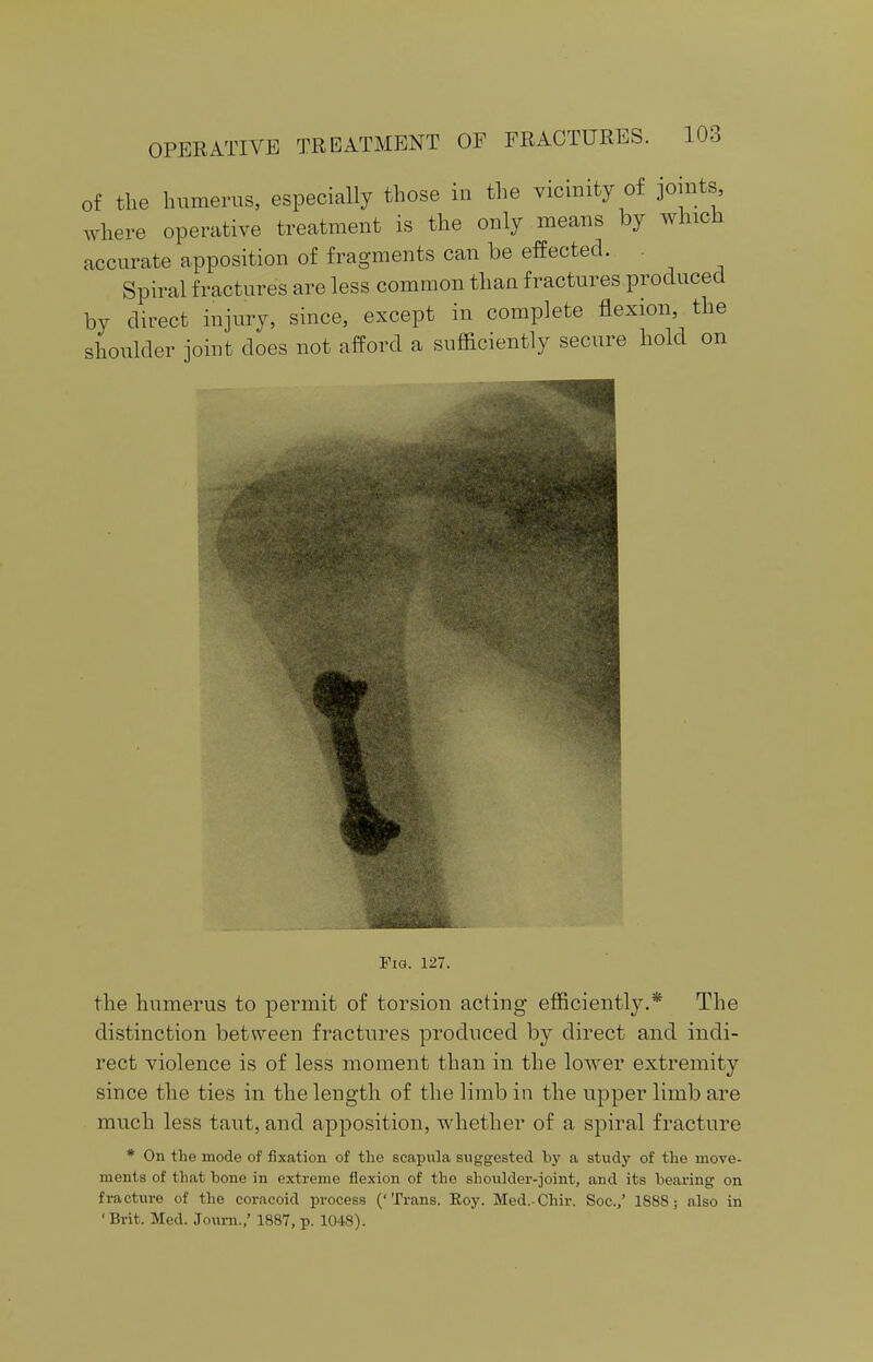 of the humerus, especially those in the vicinity of joints, where operative treatment is the only means by which accurate apposition of fragments can be effected. Spiral fractures are less common than fractures produced by direct injury, since, except in complete flexion, the shoulder joint does not afford a sufficiently secure hold on Pig. 127. the humerus to permit of torsion acting efficiently.* The distinction between fractures produced by direct and indi- rect violence is of less moment than in the lower extremity since the ties in the length of the limb in the upper limb are much less taut, and apposition, whether of a spiral fracture * On the mode of fixation of the scapula suggested by a study of the move- ments of that bone in extreme flexion of the shoulder-joint, and its bearing on fracture of the coracoid process ('Trans. Eoy. Med. Chir. Soc./ 1888; also in ' Brit. Med. Journ.,' 1887, p. 1048).