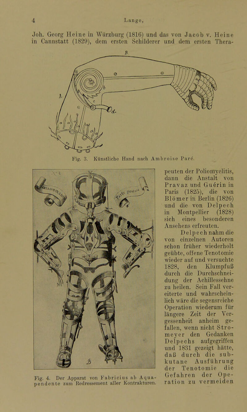 Joh. Georg Heine in Würzburg (1816) und das von Jacob v. Heine in Cannstatt (1829), dem ersten Schilderer und dem ersten Thera- Fig. 3. Künstliche Hand nach Amhroise Par6. Fig. 4. Der Apparat von Fabricius ab Aqua- pendente zum Redressement aller Kontrakturen. peuten der Poliomyelitis, dann die Anstalt von Pravaz und Guerin in Paris (1825), die von Blömer in Berlin (1826) und die von Delpech in Montpellier (1828) sich eines besonderen Ansehens erfreuten. Delpech nahm die von einzelnen Autoren schon früher wiederholt geübte, offene Tenotomie wieder auf und versuchte 1828, den lüumpfuß durch die Durchschnei- dung der Achillessehne zu heilen. Sein Fall ver- eiterte und wahrschein- lich wäre die segensreiche Operation wiederum für längere Zeit der Ver- gessenheit anheim ge- fallen, wenn nicht Stro- meycr den Gedanken Delpechs aufgegriffen und 1831 gezeigt hätte, daß durch die sub- kutane Ausführung der Tenotomie die Gefahren der Ope- ration zu vermeiden