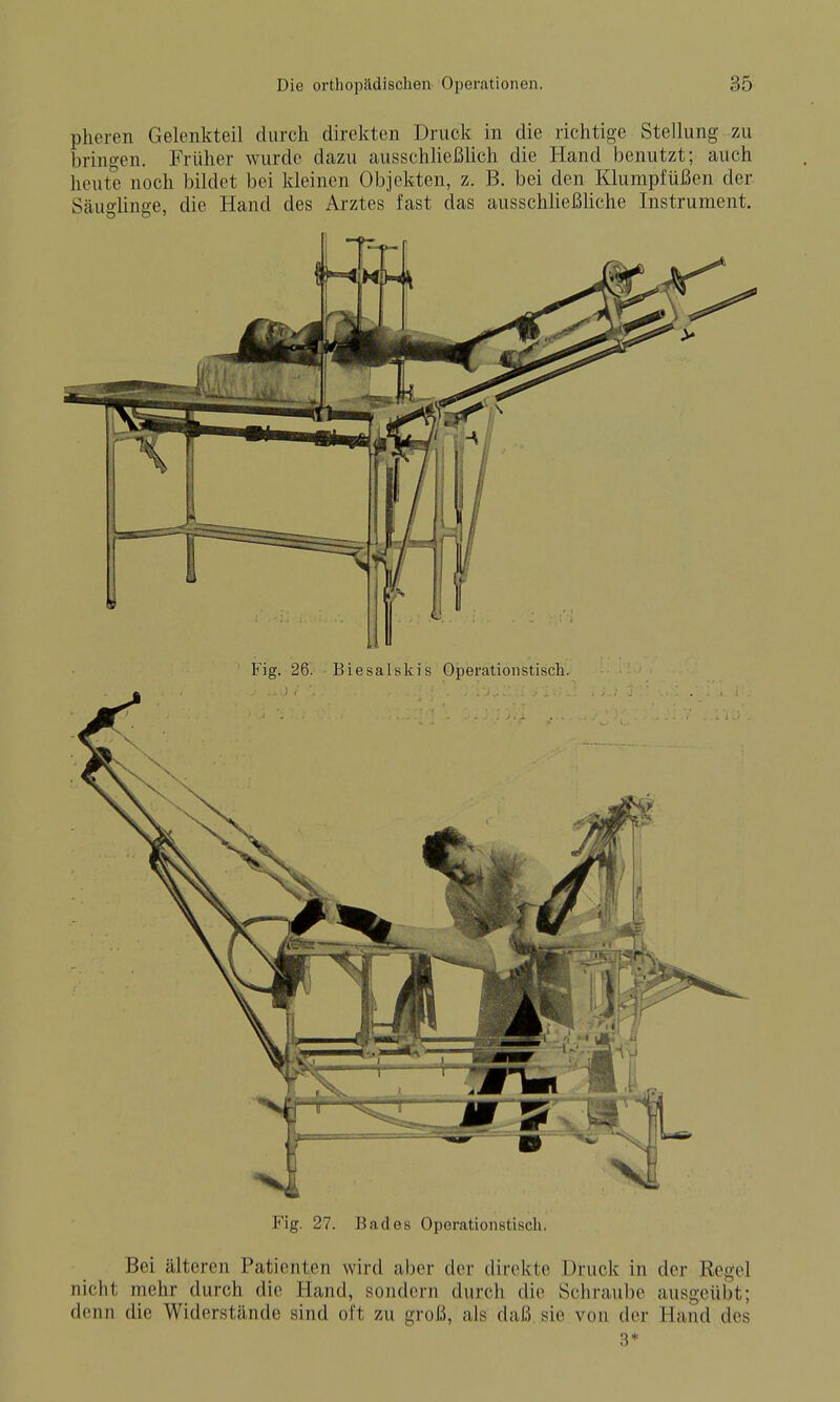 pheren Gelenkteil durch direkten Druck in die richtige Stellung zu brino-en. Früher wurde dazu ausschheßlich die Hand benutzt; auch heute noch bildet bei kleinen Objekten, z. B. bei den Klumpfüßen der Säuoiinae, die Hand des Arztes fast das ausschließhche Instrument. Fig. 26. Biesalskis Operationstisch. Fig. 27. Bades Operationstisch. Bei älteren Patienten wird aber der direkte Druck in der Regel nicht mehr durch die Hand, sondern durch die Schraube ausgeübt; denn die Widerstände sind oft zu groß, als daß sie von der Hand des 3*