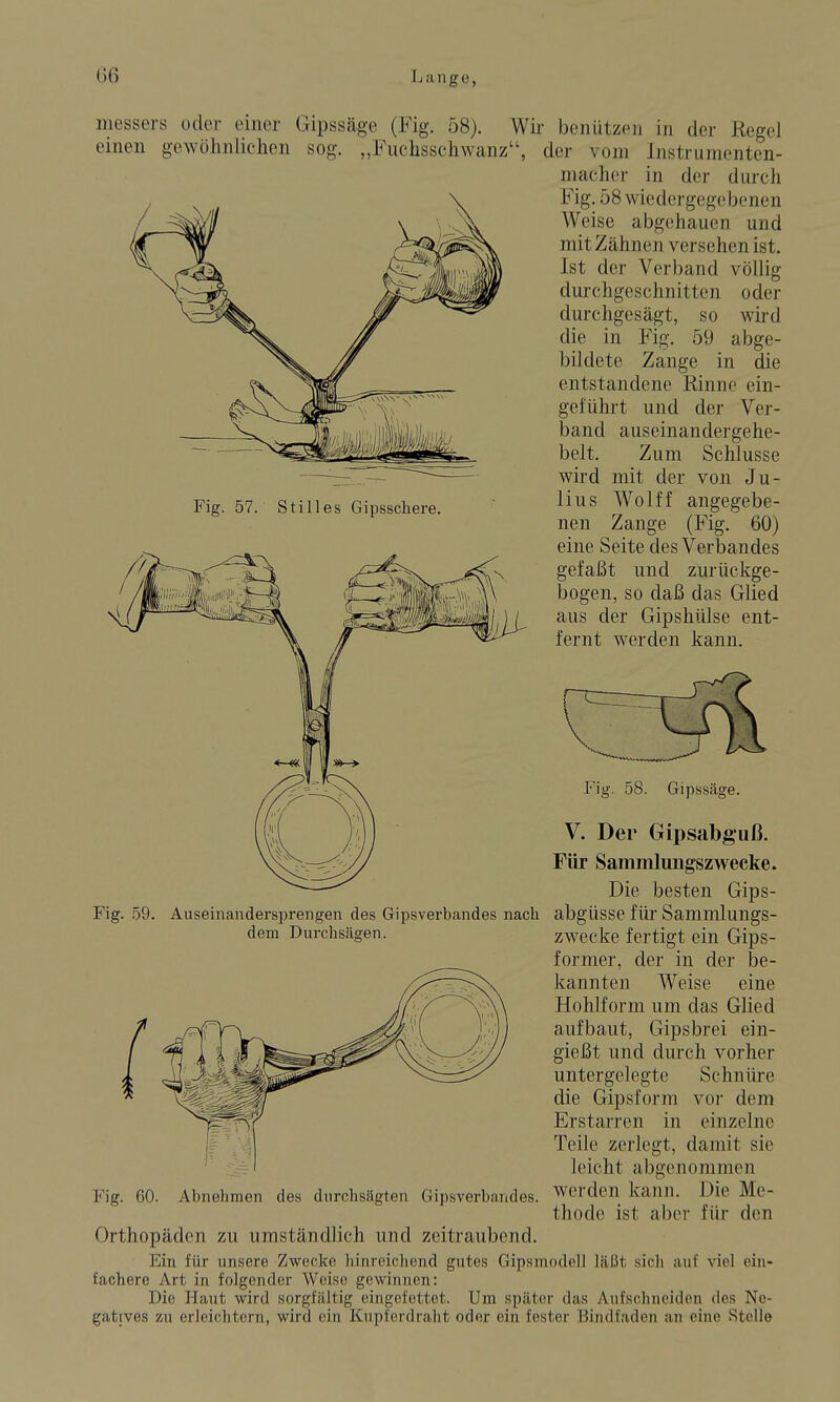 messers oder oiner Gipssäge (Fig. 58). Wir benützen in der Regel einen gewöhnlichen sog. „Fuchsschwanz, der vom Instrumenten- macher in der durch Fig. 58 wiedergegebenen Weise abgehauen und mit Zähnen versehen ist. Ist der Verband völlig durchgeschnitten durchgesägt, so 59 Fig. 57. Stilles Gipsschere. oder wird die in Fig. 59 abge- bildete Zange in die entstandene Rinne ein- geführt und der Ver- band auseinandergehe- belt. Zum Schlüsse wird mit der von Ju- lius Wolff angegebe- nen Zange (Fig. 60) eine Seite des Verbandes gefaßt und zurückge- bogen, so daß das Glied aus der Gipshülse ent- fernt werden kann. dem Durchsägen. Fig. 58. Gipssäge. V. Der Gipsabguß. Für Sammluugszwecke. Die besten Gips- Fig. 59. Auseinandersprengen des Gipsverbandes nach abgüsse für SammlungS- zwecke fertigt ein Gips- former, der in der be- kannten Weise eine Hohlform um das Glied aufbaut, Gipsbrei ein- gießt und durch vorher untergelegte Schnüre die Gipsform vor dem Erstarren in einzelne Teile zerlegt, damit sie leicht abgenommen Fig. 60. Abnehmen des durchsägten Gipsverbandes. Werden kann. Die Me- thode ist aber für den Orthopäden zu umständlich und zeitraubend. Ein für unsere Zwecke hinreichend gutes Gipsmodell läßt sich auf viel ein- fachere Art in folgender Weise gewinnen: Die Haut wird sorgfältig eingefettet. Um später das Aufschneidon des Ne- gatives zu erleichtern, wird ein Kupferdraht oder ein fester Biiulfaden an eine Stelle