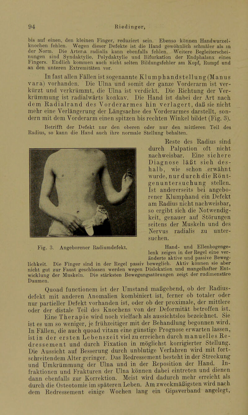 bis auf einen, den kleinen Finger, reduziert sein. Ebenso können Handwurzel- knochen fehlen. Wegen dieser Defekte ist die Hand gewöhnlich schmäler als in der Norm. Die Arteria radialis kann ebenfalls fehlen. Weitere Begleiterschei- nungen sind Syndaktylie, Polydaktylie und Bifurkation der Endphalanx eines Fingers. Endlich kommen auch nicht selten Bildungsfehler am Kopf, Rumpf und an den unteren Extremitäten vor. In fast allen Fällen ist sogenannte Klumphandstellung (Manus vara) vorhanden. Die Ulna und somit der ganze Vorderarm ist ver- kürzt und verkrümmt, die Ulna ist verdickt. Die Kichtung der Ver- krümmung ist radialwärts konkav. Die Hand ist dabei der Art nach dem Radialrand des Vorderarmes hin verlagert, daß sie nicht mehr eine Verlängerung der Längsachse des Vorderarmes darstellt, son- dern mit dem Vorderarm einen spitzen bis rechten Winkel bildet (Fig. 3). Betrifft der Defekt nur den oberen oder nur den mittleren Teil des Radius, so kann die Hand auch ihre normale Stellung behalten. Reste des Radius sind durch Palpation oft nicht nachweisbar. Eine sichere Diagnose läßt sich des- halb, wie schon erwähnt wurde, nur durch die Rönt- genuntersuchung stellen, Ist andererseits bei angebo- rener Klumphand ein Defekt am Radius nicht nachweisbar, so ergibt sich die Notwendig- keit, genauer auf Störungen seitens der Muskeln und des Nervus radialis zu unter- suchen. Fig. 3. Angeborener Radiumdefekt, Hand- und Ellenbogenge- lenk zeigen in der Regel eine ver- änderte aktive und passive Beweg- lichkeit. Die Finger sind in der Regel passiv beweglich. Aktiv können sie aber nicht gut zur Faust geschlossen werden wegen Dislokation und mangelhafter Ent- wicklung der Muskeln. Die stärksten Bewegungsstörungen zeigt der rudimenstäre Daumen. Quoad functionem ist der Umstand maßgebend, ob der Radius- defekt mit anderen Anomalien kombiniert ist, ferner ob totaler oder nur partieller Defekt vorhanden ist, oder ob der proximale, der mittlere oder der distale Teil des Knochens von der Deformität betroffen ist. Eine Therapie wird noch vielfach als aussichtslos bezeichnet. Sie ist es um so weniger, je frühzeitiger mit der Behandlung begonnen wii-d. In Fällen, die auch quoad vitam eine günstige Prognose erwarten lassen, ist in der ersten Lebenszeit viel zu erreichen durch manuelles Re- dressement und durch Fixation in möglichst korrigierter Stellung. Die Aussicht auf Besserung durch unblutige Verfahren wird mit fort- schreitendem Alter geringer. Das Redressement besteht in der Streckung und Umkrümmung der Ulna und in der Reposition der Hand. In- fraktionen und Frakturen der Ulna können dabei eintreten und dienen dann ebenfalls zur Korrektion. Meist wird dadurch mehr erreicht als durch die Osteotomie im späteren Leben. Am zweckmäßigsten wird nach dorn Redressement einige Wochen lang ein Gipsverband angelegt,