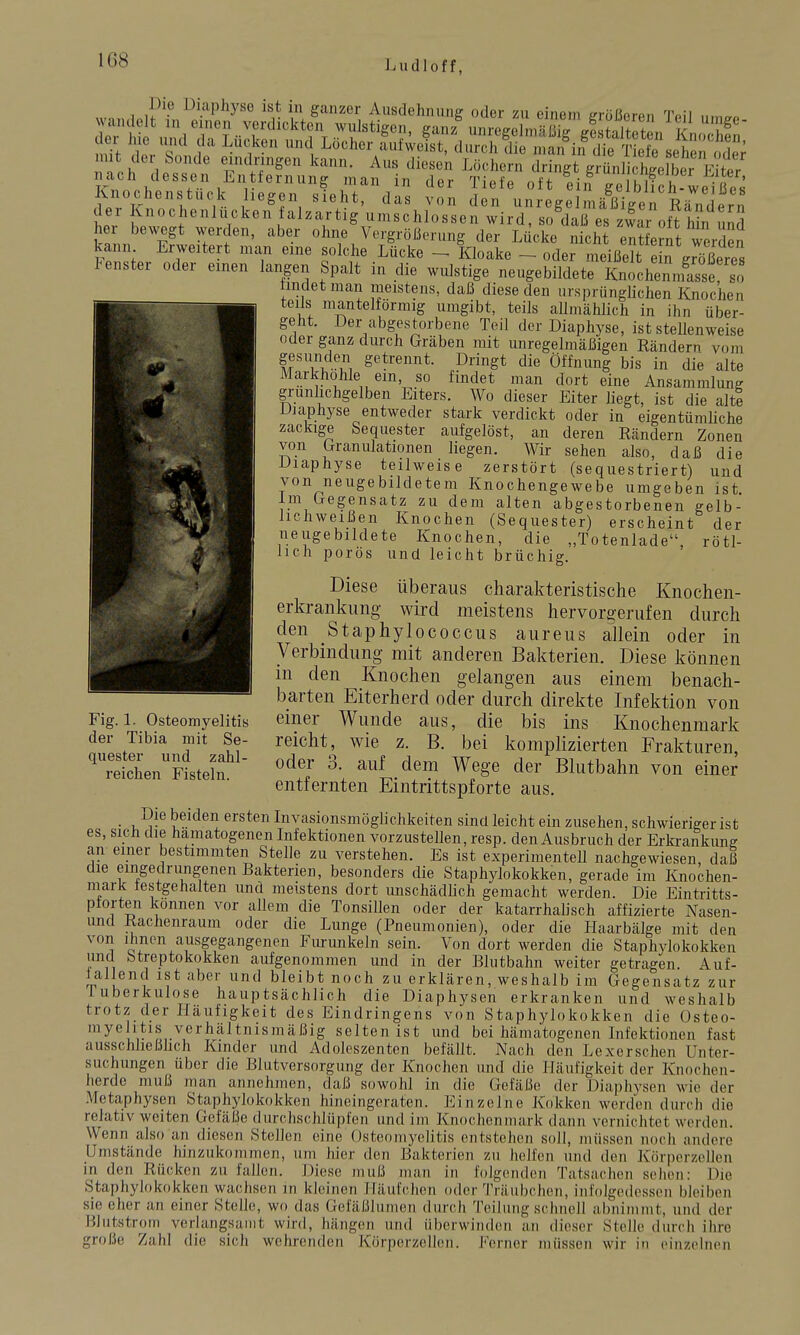 Die Diapliyse ist in ganzer Ausdehnung oder zu einem erüßeren Tpü un^.o Fenster oder einen langen Spalt in die wulstige neugebildete KnochennSe so imdetman meistens, daß diese den ursprünglichen Knochen teils mantelformig umgibt, teils allmählich in ihn über- geht. Der abgestorbene Teil der Diaphyse, ist steUenweise oder ganz durch Gräben mit unregelmäßigen Rändern vom gesunden getrennt. Dringt die Öffnung bis in die alte Markhohle ein, so findet man dort eine Ansammlung grunhchgelben Eiters. Wo dieser Eiter liegt, ist die alte Diaphyse entweder stark verdickt oder in eigentümliche zackige Sequester aufgelöst, an deren Rändern Zonen von Crranulationen liegen. Wir sehen also, daß die Uiaphyse teilweise zerstört (sequestriert) und von neugebildetem Knochengewebe umgeben ist Im Gegensatz zu dem alten abgestorbenen gelb- lichweißen Knochen (Sequester) erscheint der neugebildete Knochen, die „Totenlade, rötl- lich porös und leicht brüchig. Diese überaus charakteristische Knochen- erkrankimg wird meistens hervorg-erufen durch den Staphylococcus aureus allein oder in Verbindung mit anderen Bakterien. Diese können m den Knochen gelangen aus einem benach- barten Eiterherd oder durch direkte Infektion von einer Wunde aus, die bis ins Knochenmark reicht, wie z. B. bei komplizierten Frakturen, oder 3. auf dem Wege der Blutbahn von einer entfernten Eintrittspforte aus. Die beiden ersten Invasionsmöglichkeiten sind leicht ein zusehen, schwieriger ist es, sich die hamatogenen Infektionen vorzustellen, resp. den Ausbruch der Erki-ankun^ an einer bestimmten Stelle zu verstehen. Es ist experimentell nachgewiesen, daß die eingedrungenen Bakterien, besonders die Staphylokokken, gerade im Knochen- mark festgehalten und meistens dort unschädlich gemacht werden. Die Eintritts- pforten können vor allem die Tonsillen oder der katarrhalisch affizierte Nasen- und Rachenraum oder die Lunge (Pneumonien), oder die Haarbälge mit den von Ihnen ausgegangenen Furunkeln sein. Von dort werden die Staphylokokken und Streptokokken aufgenommen und in der Blutbahn weiter getragen. Auf- lal end ist aber und bleibt noch zu erklären, weshalb im Gegensatz zur tuberkulöse hauptsächlich die Diaphysen erkranken und weshalb trotz der Häufigkeit des Eindringens von Staphylokokken die Osteo- myelitis verhältnismäßig selten ist und bei hamatogenen Infektionen fast ausschheßhch Kinder und Adokszenten befällt. Nach den Lexerschen Unter- suchungen über die Blutversorgung der Knochen und die Häufigkeit der Knochen- herde muß man annehmen, daß sowohl in die Gefäße der Diaphysen wie der -Metaphysen Staphylokokken hineingeraten. Einzelne Kokken werden durch die relativ weiten Gefäße durchschlüpfen und im Knochenmark dann vernichtet werden. Wenn also an diesen Stellen eine Osteomyelitis entstehen soJI, müssen noch andere Umstände hinzukommen, um hier den Bakterien zu helfen uml den Körperzellen in den Rücken zu fallen. Diese mul.1 man in folgenden Tatsachen sehen: Die Staphylokokken wachsen in kleinen Häufchen oder Träubchen, infolgedessen bleiben sie eher an einer Stelle, wo das Gefäßliimen durcli Teilung schnell abnimmt, und der Biutstrom verlangsamt wird, hängen und überwintlen an dieser Stelle durch ihre große Zahl die sich wehrenden Körperzellen. Ferner müssen wir in einzelnen Fig. 1. Osteomyelitis der Tibia mit Se- quester und zahl- reichen Fisteln.