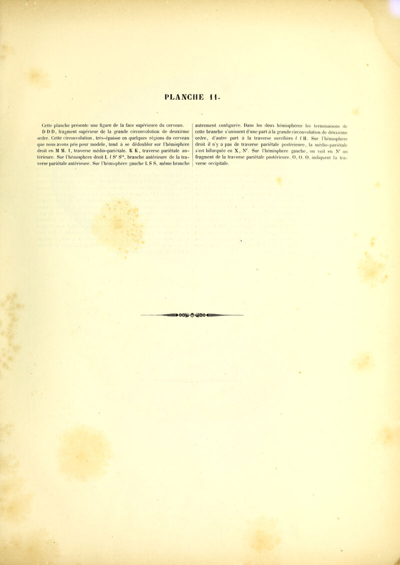 Cette planche présente une figure de la face supérieure du cerveau. DDD, fragment supérieur de la grande circonvolution de deuxième ordre. Cette circonvolution, très-épaisse en quelques régions du cerveau que nous avons pris pour modèle, tend à se dédoubler sur l'hémisphère droit en M M. I, traverse médio-pariétale. K K, traverse pariétale an- térieure. Sur l'hémisphère droit L / S' S, branche antérieure de la tra- verse pariétale antérieure. Sur l'hémisphère gauche LS S, même branche autrement conligurée. Dans les deux hémisphères les lernunaisons de cette branche s'unissent d'une part à la grande circonvolution de deuxième ordre, d'autre part à la traverse surcilière / / H. Sur l'hémisphère droit il n'y a pas de traverse pariétale postérieure, la médio-pariétale s'est bifurquée en X, N'. Sur l'hémisphère gauche, on voit en N' un fragment de la traverse pariétale postérieure. 0, 0. 0, indiquent la tra- verse occipitale.