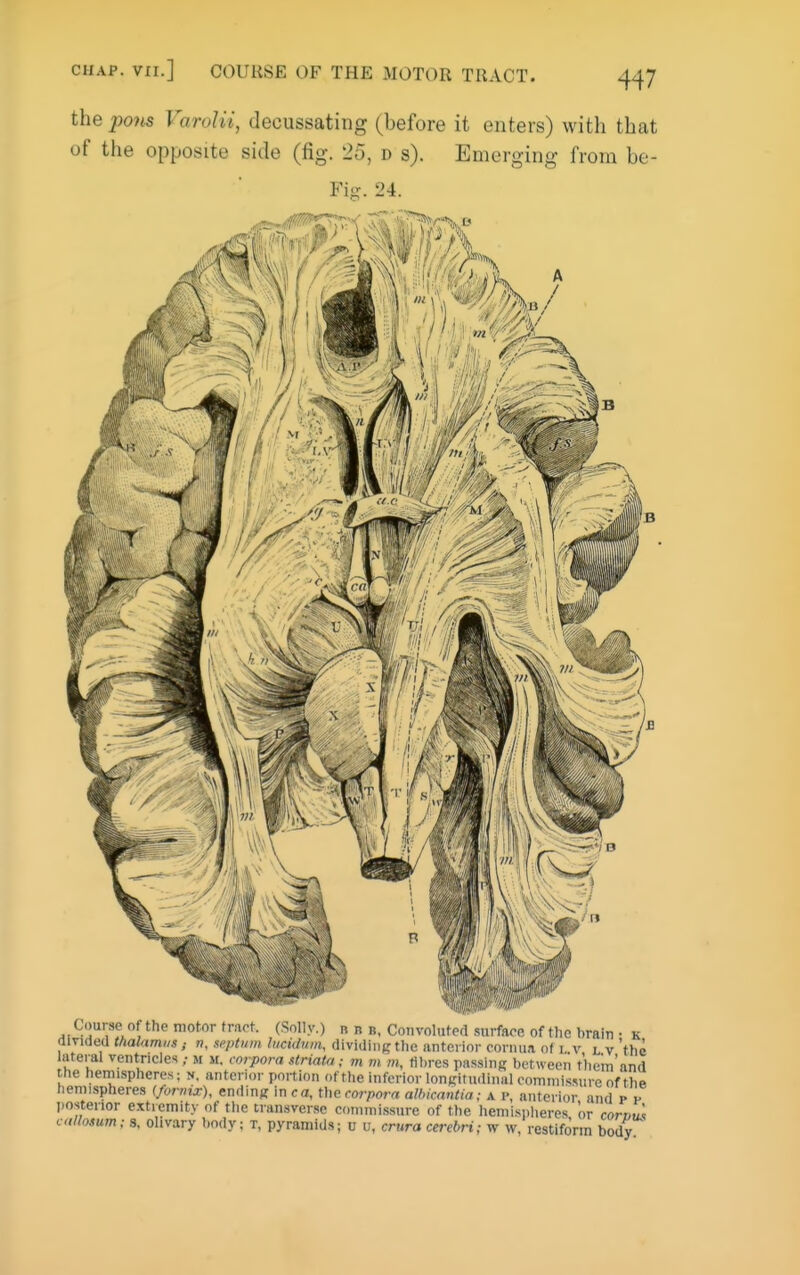 CUAP. vxi.] COURSE OF THE 3I0T0R TRACT. the pons Varolii, decussating (before it enters) with that of the opposite side (fig. 25, d s). Emerging from be- Fitr. 24. Course of the motor tract. (Solly.) n n b, Coiivolutpfl surface of the hrain • k divided thalamusn, septum liicklnm, dividing the anterior coriuia of i. v l v 'the lateral ventricles m m. corpora striata ; m m m, fibres passing between tbein'nnd the hemispheres; n, anterior portion of the inferior longituilinal oomniissure of the hemispheres (/oniix), ending in ca, the corpora albicantia; a p, anterior and p y Iiosterior extremity of the transverse commissure of the hemisplieres or corvu!, calhsum; s, olivary body; t, pyramids; u u, crura cerebri; w w, restiforin body
