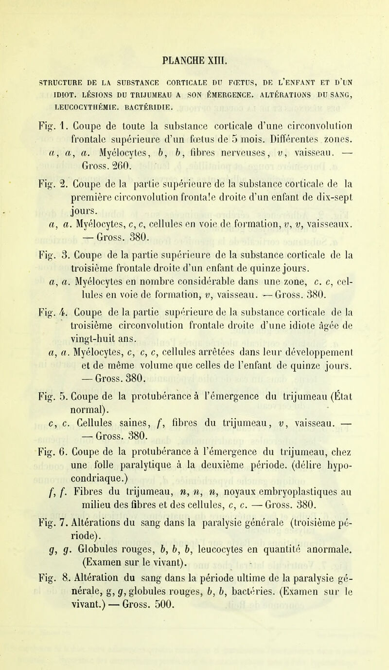STRUCTURE DE LA SUBSTANCE CORTICALE DU FŒTUS, DE l'ENFANT ET D'LN IDIOT. LÉSIONS DU TRIJUMEAU A SON ÉMERGENCE. ALTÉRATIONS DU SANG, LEUCOCYTHÉMIE. BACTÉRIDIE. Fig. 1. Coupe de toute la substance corticale d'une circonvolution frontale supérieure d'un fœtus de 5 mois. Différentes zones, rt, ft, a. Myélocytes, 6, 5, fibres nerveuses, v, vaisseau. — Gross. 560. Fi£>-. 5. Coupe de la partie supérieure de la substance corticale de la première circonvolution frontale droite d'un enfant de dix-sept jours. a, a. Myélocytes, c, c, cellules en voie de formation, v, vaisseaux. — Gross. 380. Fig'. 3. Coupe de la partie supérieure de la substance corticale de la troisième frontale droite d'un enfant de quinze jours, a, a. Myélocytes en nombre considérable dans une zone, c. c, cel- lules en voie de formation, v, vaisseau. — Gross. 380. Fig. 4. Coupe de la partie supérieure de la substance corticale de la troisième circonvolution frontale droite d'une idiote âgée de vingt-huit ans. a, a. Myélocytes, c, c, c, cellules arrêtées dans leur développement et de même volume que celles de l'enfant de quinze jours. — Gross. 380. Fig. 5. Coupe de la protubérance à l'émergence du trijumeau (État normal). c, c. Cellules saines, /, fibres du trijumeau, v, vaisseau. — — Gross. 380. Fig. 6. Coupe de la protubérance à l'émergence du trijumeau, chez une folle paralytique à la deuxième période, (délire hypo- condriaque.) /, f. Fibres du trijumeau, n, n, n, noyaux embryoplastiques au milieu des fibres et des cellules, c, c. — Gross. 380. Fig. 7. Altérations du sang dans la paralysie générale (troisième pé- riode). g, g. Globules rouges, b, b, b, leucocytes en quantité anormale. (Examen sur le vivant). Fig. 8. Altération du sang dans la période ultime de la paralysie gé- nérale, g, g, globules rouges, b, b, bactéries. (Examen sur le vivant.) — Gross. 500.