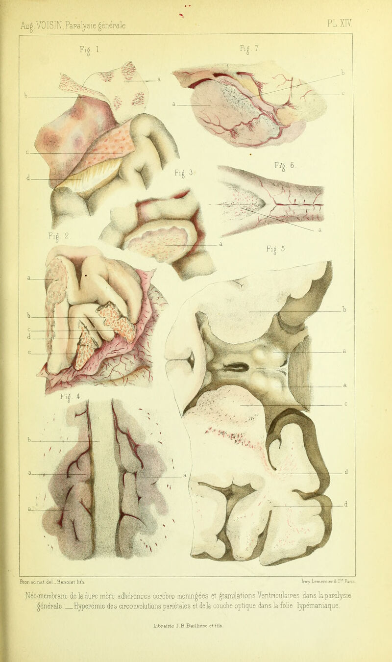 Librairie J.B.Baillièpe et fils