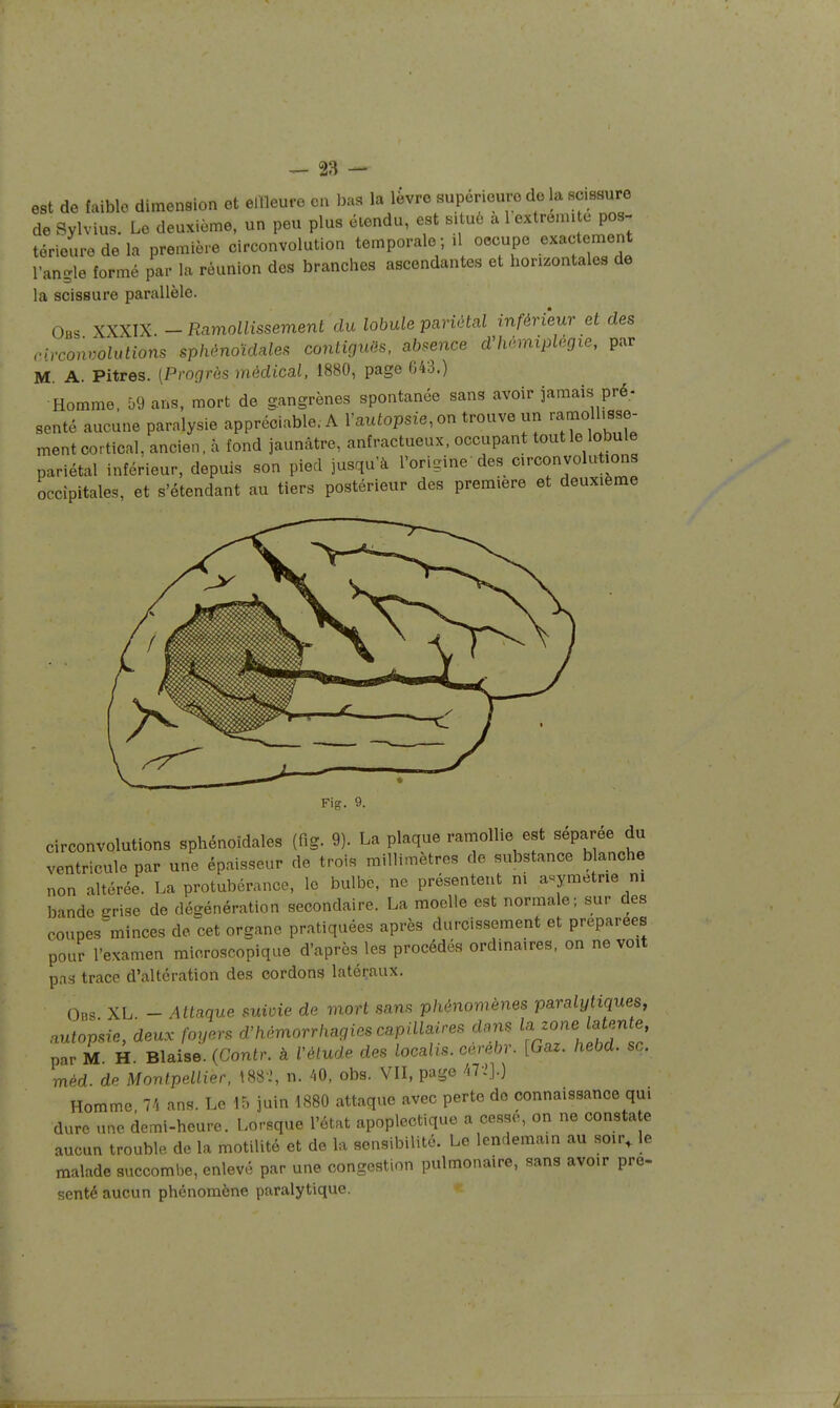 est de faiblo dimension et ellleure en bas la lèvre supérieure de la scissure de Bylvius. Le deuxième, un peu plus étendu, est s.tuè a 1 extrémité pos- térieure de la première circonvolution temporale ; .1 oocupe exactement l'angle formé par la réunion des branches ascendantes et horizontales de la scissure parallèle. Obs XXXIX. -Ramollissement du lobule pariétal inférieur et des circonvolutions sphônoïdales contiguës, absence d^hémiplégxe, par M A. Pitres. [Progrés médical, 1880, page 643.) Homme. Ô9 ans, mort de gangrènes spontanée sans avoir jamais pré; sente aucune paralysie appréciable. A l'aufopsie, on trouve un ra^aolhsse- mentcortical, ancien, à fond jaunâtre, anfractueux, occupant tout le lobule pariétal inférieur, depuis son pied jusqu'à l'origine des circonvolutions occipitales, et s'étendant au tiers postérieur des première et deuxième Fig. 9. Circonvolutions sphénoïdales (fig. 9). La plaque ramollie est séparée du ventricule par une épaisseur de trois millimètres de substance blanche non altérée. La protubérance, le bulbe, ne présentent m aYmetrie ni bande grise de dégénération secondaire. La moelle est normale; sur des coupes minces de cet organe pratiquées après durcissement et préparées pour l'examen microscopique d'après les procédés ordinaires, on ne voit pas trace d'altération des cordons latéraux. Obs XL - Attaque suivie de mort sans phénomènes paralytiques, nutopsie, deux foyers d'hèmorrhagies capillaires dans la zone latente, par M H. Biaise. (Contr. à l'élude des localis. cérébr. [Gaz. hebd. se. mM. de Montpellier, 1882, n. 40, obs. VII, page 47ij.) Homme 74 ans. Le 15 juin 1880 attaque avec perte do connaissance qui dure une demi-heure. Lorsque l'état apoplectique a cesse, on ne constate aucun trouble de la motilité et de la sensibilité. Le lendemain au soir, le malade succombe, enlevé par une congestion pulmonaire, sans avoir pré- senté aucun phénomène paralytique.