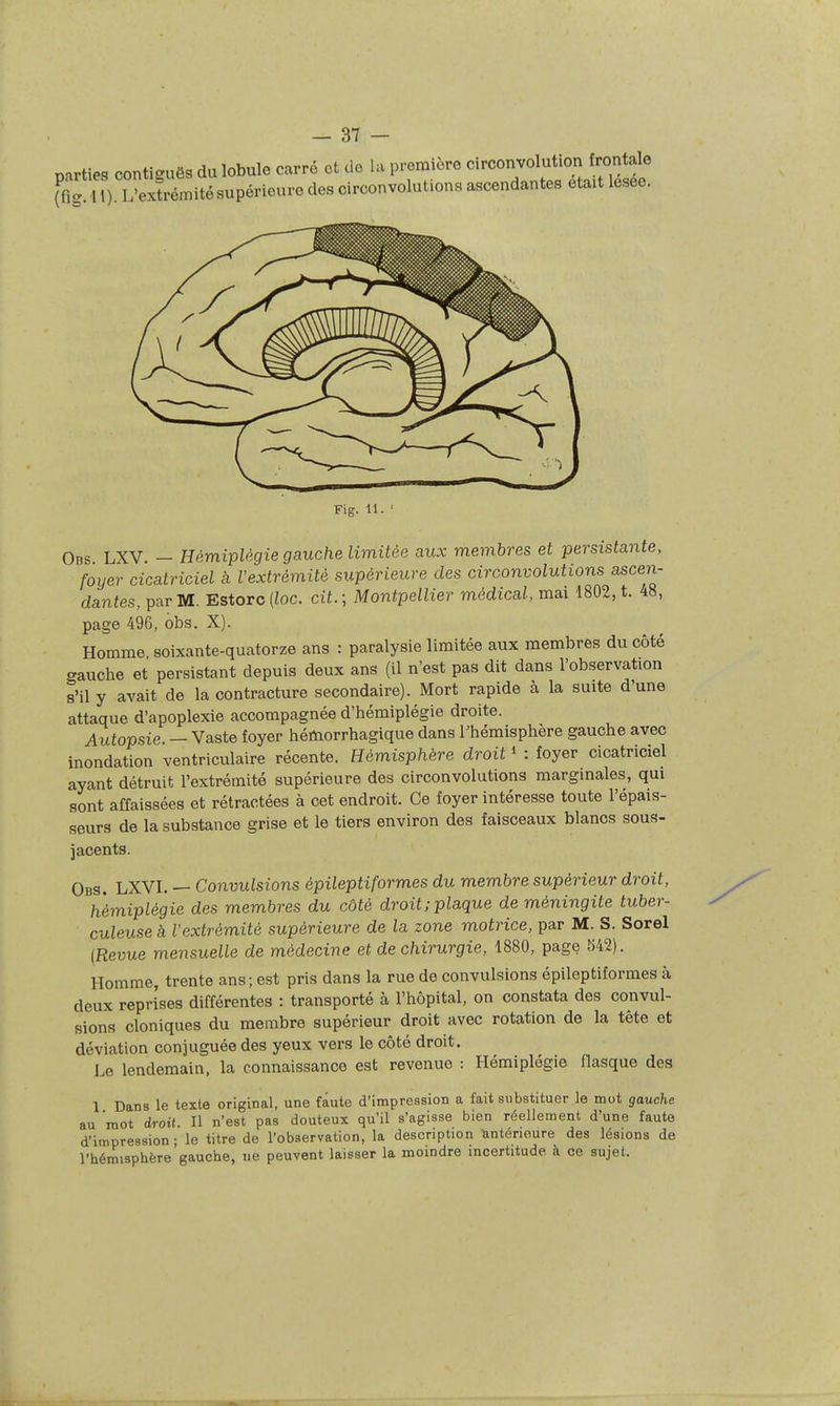 parties contiguës du lobule carré et do la première circonvolution frontale (î?ri i) L'exfrémité supérieure des circonvolutions ascendantes était lesee. Fig. 11. ' Obs LXV. - Hémiplégie gauche limitée aux membres et persistante, foyer cicatriciel à l'extrémité supérieure des circonvolutions ascen- dantes, par M. Estorc (Zoc. cit.; Montpellier médical, mai 1802, t. 48, page 496, obs. X). Homme, soixante-quatorze ans : paralysie limitée aux membres du côté gauche et persistant depuis deux ans (il n'est pas dit dans l'observation s'il y avait de la contracture secondaire). Mort rapide à la suite d'une attaque d'apoplexie accompagnée d'hémiplégie droite. Autopsie. — Vaste foyer hémorrhagique dans Thémisphère gauche avec inondation ventriculaire récente. Hémisphère droit ' : foyer cicatriciel ayant détruit l'extrémité supérieure des circonvolutions marginales, qui sont affaissées et rétractées à cet endroit. Ce foyer intéresse toute l'épais- seurs de la substance grise et le tiers environ des faisceaux blancs sous- jacents. Obs. LXVI. — Convulsions épileptiformes du membre supérieur droit, hémiplégie des membres du côté droit; plaque de méningite tuber- culeuse à Vextrémité supérieure de la zone motrice, par M. S. Sorel (Reuue mensuelle de médecine et de chirurgie, 1880, page 542). Homme, trente ans; est pris dans la rue de convulsions épileptiformes à deux reprises différentes : transporté à l'hôpital, on constata des convul- sions cloniques du membre supérieur droit avec rotation de la tète et déviation conjuguée des yeux vers le côté droit. Le lendemain, la connaissance est revenue : Hémiplégie flasque des 1 Dans le texte original, une faute d'impression a fait substituer.le mot gauche au root droit. H n'est pas douteux qu'il s'agisse bien réellement d'une faute d'impression; le titre de l'observation, la description lanténeure des lésions de l'hémisphère'gauche, ne peuvent laisser la moindre incertitude à ce sujet.