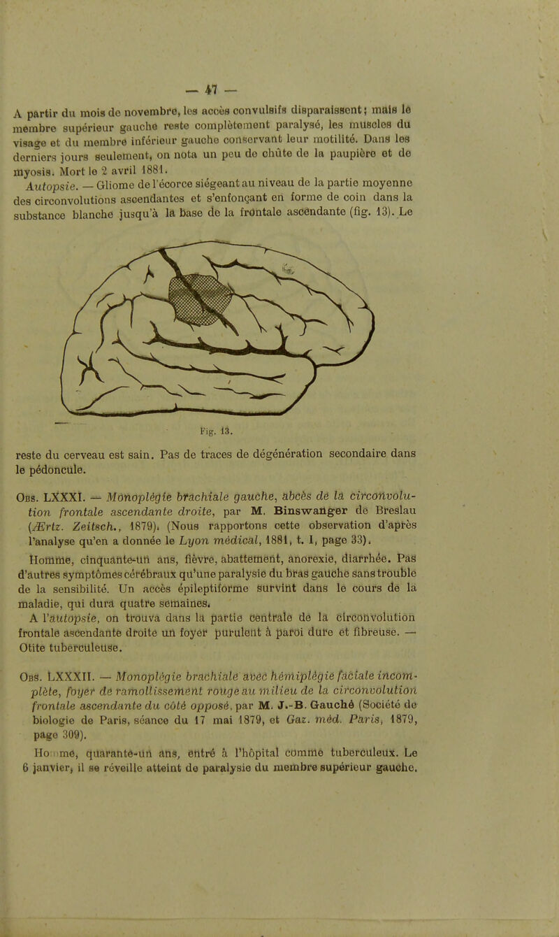 A partir du mois de novembre, lea accès convulBifs disparaisBont ; mais lo membre supérieur gauche reste complètement paralysé, les muscles du visao-e et du membre inférieur gauche conservant leur motilité. Dans les derniers jours seulement, on nota un peu do chûte de la paupière et do myosis. Mort le 2 avril 1881. Autopsie. — Gliome del'écorce siégeant au niveau de la partie moyenne des circonvolutions ascendantes et s'enfonçant en forme de coin dans la substance blanche jusqu'à la base de la frontale ascendante (fig. 13). Le Fig. 13. reste du cerveau est sain. Pas de traces de dégénération secondaire dans le pédoncule. Obs. LXXXI. — Monoplégie bfachiale gauche, abcès de la circonvolu- tion frontale ascendante droite, par M. Binswaûger de Breslau [Mrtz. Zeitsch., 1879). (Nous rapportons cette observation d'apt-ès l'analyse qu'en a donnée le Lyon médical, 1881, t. 1, page 33) * îîomme, cinquante-Utl ans, flèvfê, abattement, anorexie, diarrhée. Pâë d'autres symptômes cérébraux qu'une paralysie du bras gaUdhe sans trouble de la sensibilité. Un accès épileptiforme survint dans le cours de la maladie, qui dura quatre semaineSé A Vâutôpsie, on tt-ouva dans la partie dèntfale dé la circonvolution frontale ascendante droite un foyer purulent â paroi dure et fibreuse. — Otite tuberculeuse. Obs. LXXXII. — Monoplégie brâchialô' âvôô hémiptêgié faciale incom- plète, foyêr dé ramollissem&nt roUge au milieu de la circonvolution frontale ascendante du côté opposé, par M. J.-B. Gauché (Société de biologie de Paris, séance du 17 mai 1879, et Gaz. méd. Paris, 1879, page 309). Ho iime, quarantô-un âtis, entré à l'hôpital commé tuberculeux. Le 6 janvier, il se réveille atteint de paralysie du membre supérieur gauche.