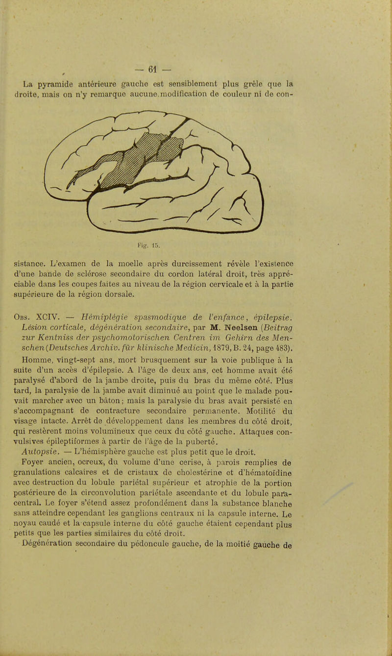 La pyramide antérieure gauche est sensiblement plus grêle que la droite, mais on n'y remarque aucune.modification do couleur ni de con- Fig. 15. sistance. L'examen de la moelle après durcissement révèle l'existence d'une bande de sclérose secondaire du cordon latéral droit, très appré- ciable dans les coupes faites au niveau de la région cervicale et à la partie supérieure de la région dorsale. Obs. XCIV. — Hémiplégie spasmodique de l'enfance, épilepsie. Lésion corticale, dégénération secondaire, par M. Neelsen {Beitrag zur Kentniss der psychomotorischen Centren im Gehirn des Men- schen{Deutsches Archiv. fûr hlinische Medicin, 1879, B. 24, page 483). Homme, vingt-sept ans, mort brusquement sur la voie publique à la suite d'un accès d'épilepsie. A l'âge de deux ans, cet homme avait été paralysé d'abord de la jambe droite, puis du bras du même côté. Plus tard, la paralysie de la jambe avait diminué au point que le malade pou- vait marcher avec un bâton ; mais la paralysie du bras avait persisté en s'accompagnant de contracture secondaire permanente. Motilité du visage intacte. Arrêt de développement dans les membres du côté droit, qui restèrent moins voluniineux que ceux du côté gauche. Attaques con- vulsiveg épileptiformes à partir de l'âge de la puberté. Autopsie. — L'hémisphère gauche est plus petit que le droit. Foyer ancien, ocreux-, du volume d'une cerise, à parois remplies de granulations calcaires et de cristaux de cholestérine et d'hé.matoïdine avec destruction du lobule pariétal supérieur et atrophie de la portion postérieure de la circonvolution pariétale ascendante et du lobule para- central. Le foyer s'étend assez profondément dans la substance blanche sans atteindre cependant les ganglions centraux ni la capsule interne. Le noyau caudé et la capsule interne du côté gauche étaient cependant plus petits que les parties similaires du côté droit. Dégénération secondaire du pédoncule gauche, de la moitié gauche de