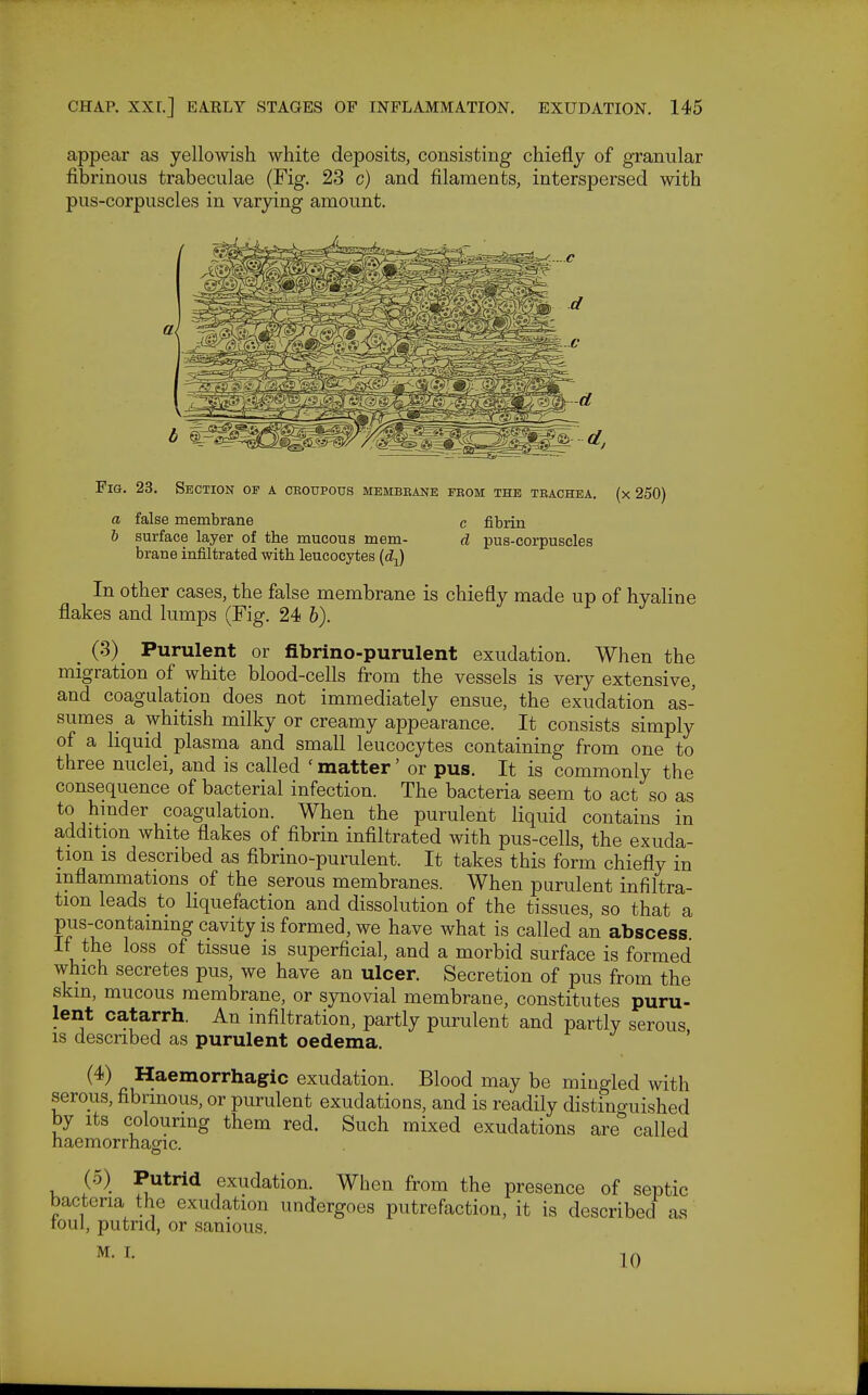 appear as yellowish white deposits, consisting chiefly of granular fibrinous trabeculae (Fig. 23 c) and filaments, interspersed with pus-corpuscles in varying amount. Fig. 23. Section of a croupous membrane from the trachea, (x 250) a false membrane c fibrin b surface layer of the mucous mem- d pus-corpuscles brane infiltrated with leucocytes (dy) In other cases, the false membrane is chiefly made up of hyaline flakes and lumps (Fig. 24 b). . (•^). Purulent or fibrino-purulent exudation. When the migration of white blood-cells from the vessels is very extensive, and coagulation does not immediately ensue, the exudation as- sumes a whitish milky or creamy appearance. It consists simply of a liquid plasma and small leucocytes containing from one to three nuclei, and is called ' matter' or pus. It is commonly the consequence of bacterial infection. The bacteria seem to act so as to hmder coagulation. When the purulent liquid contains in addition white flakes of fibrin infiltrated with pus-cells, the exuda- tion IS described as fibrino-purulent. It takes this form chiefly in inflammations of the serous membranes. When purulent infiltra- tion leads to liquefaction and dissolution of the tissues, so that a pus-contammg cavity is formed, we have what is called an abscess It the loss of tissue is superficial, and a morbid surface is formed which secretes pus, we have an ulcer. Secretion of pus from the skin, mucous membrane, or synovial membrane, constitutes puru- lent catarrh. An infiltration, partly purulent and partly serous is described as purulent oedema. (4) Haemorrhagic exudation. Blood may be mingled with serous, fibrinous, or purulent exudations, and is readily distinguished by Its colouring them red. Such mixed exudations are'' called naemorrhaofic. (5) Putrid exudation. When from the presence of septic bacteria the exudation undergoes putrefaction, it is described as toul, putrid, or sanious. M. 1. 10