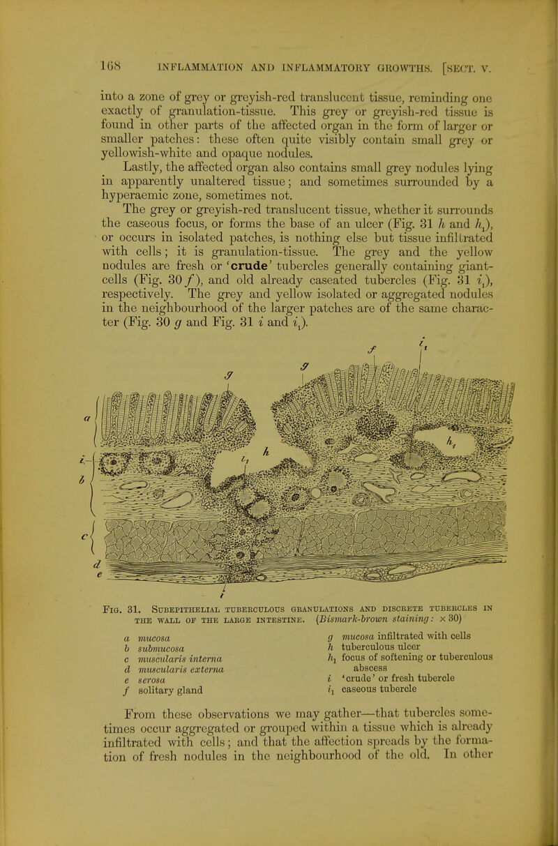 into a zone of grey or greyish-red translucent tissue, reminding one exactly of granulation-tissue. This grey or greyish-red tissue is found in other parts of the affected organ in the form of larger or smaller patches: these often quite visibly contain small grey or yellowish-white and opaque nodules. Lastly, the affected organ also contains small grey nodules lying in apparently unaltered tissue; and sometimes surrounded by a hyperaemic zone, sometimes not. The grey or greyish-red translucent tissue, whether it surrounds the caseous focus, or forms the base of an ulcer (Fig, 31 h and h^, or occurs in isolated patches, is nothing else but tissue infil'irated with cells; it is granulation-tissue. The grey and the yellow nodules are fresh or 'crude' tubercles generally containing giant- cells (Fig. 30 /), and old already caseated tubercles (Fig. 31 i^, respectively. The grey and yellow isolated or aggregated nodules in the neighbourhood of the larger patches are of the same charac- ter (Fig. 30 g and Fig. 31 i and i^. Fig. 31. Subepithelial tuberculous geanulations and discebte tubebcles in THE wall of the laege INTESTINE. [Bismarlc-brown staining: x 30) g mucosa infiltrated with cells h tuberculous ulcer /«! focus of softening or tuberculous abscess i ' crude' or fresh tubercle a mucosa h suhmucosa c muscularis interna d muscularis externa e serosa f solitary gland /, caseous tubercle From these observations we may gather—that tubercles some- times occur aggregated or grouped within a tissue which is already infiltrated with cells; and that the affection spreads by the forma- tion of fresh nodules in the neighbourhood of the old. In other