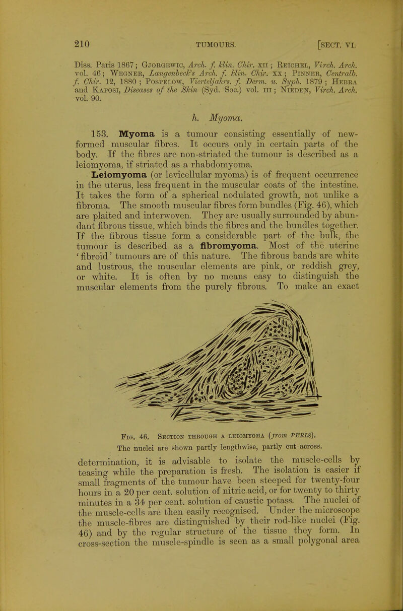 Diss. Paris 1867; Gjorgewic, Arch. f. Min. Chir. xti ; Reichel, Virch. Arch. vol. 46; Weqner, LangenhecFs Arch. f. Min. Chir. xx; Pinner, Ccrdralh. f. Chir. 12, 1880 ; Pospelow, Vicrldjahrs. f. Derm. u. Syph. 1879 ; Hebra and Kaposi, Diseases of the Skin (Syd. Soc.) vol. iii; Nieden, Virch. Arch. vol. 90. h. Myoma. 153. Myoma is a tumour consisting essentially of new- formed muscular fibres. It occurs only in certain parts of the body. If the fibres are non-striated the tumour is described as a leiomyoma, if striated as a rhabdomyoma. Leiomyoma (or levicellular myoma) is of frequent occurrence in the uterus, less frequent in the muscular coats of the intestine. It takes the form of a spherical nodulated growth, not unlike a fibroma. The smooth muscular fibres form bundles (Fig. 46), which are plaited and interwoven. They are usually surrounded by abun- dant fibrous tissue, which binds the fibres and the bundles together. If the fibrous tissue form a considerable part of the bulk, the tumour is described as a fibromyoma. Most of the uterine ' fibroid' tumours are of this nature. The fibrous bands are white and lustrous, the muscular elements are pink, or reddish grey, or white. It is often by no means easy to distinguish the muscular elements from the purely fibrous. To make an exact Fig. 46. Section through a leiomyoma {jrom perls). The nuclei are shown partly lengthwise, partly cut across. determination, it is advisable to isolate the muscle-cells by teasing while the preparation is fresh. The isolation is easier if small fragments of the tumour have been steeped for twenty-four hours in a 20 per cent, solution of nitric acid, or for twenty to thirty minutes in a 34 per cent, solution of caustic potass. The nuclei of the muscle-cells are then easily recognised. Under the microscope the muscle-fibres are distinguished by their rod-like nuclei (Fig. 46) and by the regular structure of the tissue they form. In cross-section the muscle-spindle is seen as a small polygonal area