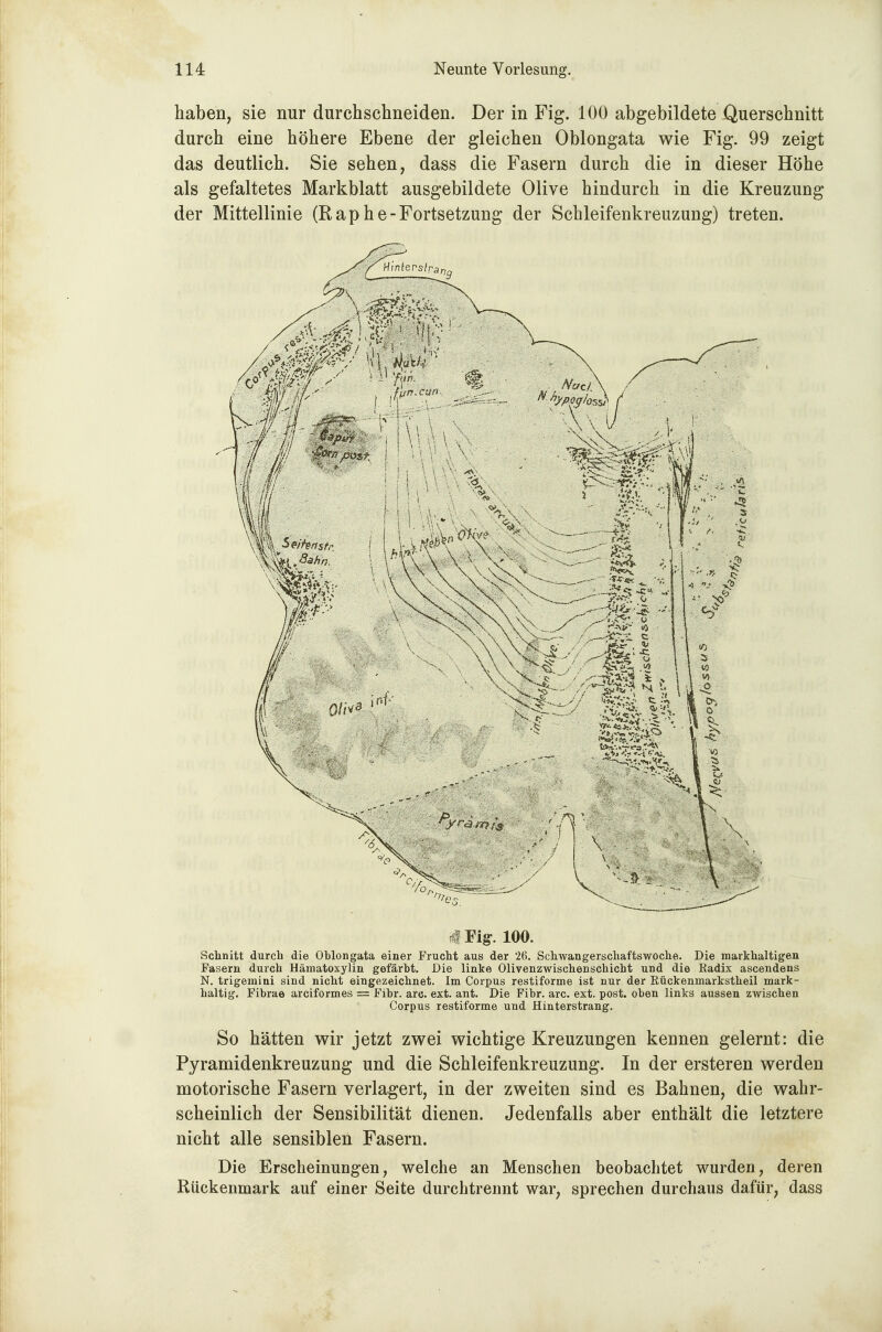 haben, sie nur durchschneiden. Der in Fig. 100 abgebildete -Querschnitt durch eine höhere Ebene der gleichen Oblongata wie Fig. 99 zeigt das deutlich. Sie sehen, dass die Fasern durch die in dieser Höhe als gefaltetes Markblatt ausgebildete Olive hindurch in die Kreuzung der Mittellinie (Raphe-Fortsetzung der Schleifenkreuzung) treten. jfFig^. 100. Schnitt durch die Ohlongata einer Frucht aus der 26. Schwangerschaftswoche. Die markhaltigen Fasern durch Hämatoxylin gefärht. Die linke Olivenzwischenschicht und die Radix ascendens N. trigeinini sind nicht eingezeichnet. Im Corpus restiforme ist nur der ßückenmarkstheil mark- haltig. Fihrae arciformes = Fihr. arc. ext. ant. Die Fihr. arc. ext. post. oben links aussen zwischen Corpus restiforme und Hinterstrang. So hätten wir jetzt zwei wichtige Kreuzungen kennen gelernt: die Pyramidenkreuzung und die Schleifenkreuzung. In der ersteren werden motorische Fasern verlagert, in der zweiten sind es Bahnen, die wahr- scheinlich der Sensibilität dienen. Jedenfalls aber enthält die letztere nicht alle sensiblen Fasern. Die Erscheinungen, welche an Menschen beobachtet wurden, deren Rückenmark auf einer Seite durchtrennt war, sprechen durchaus dafür, dass