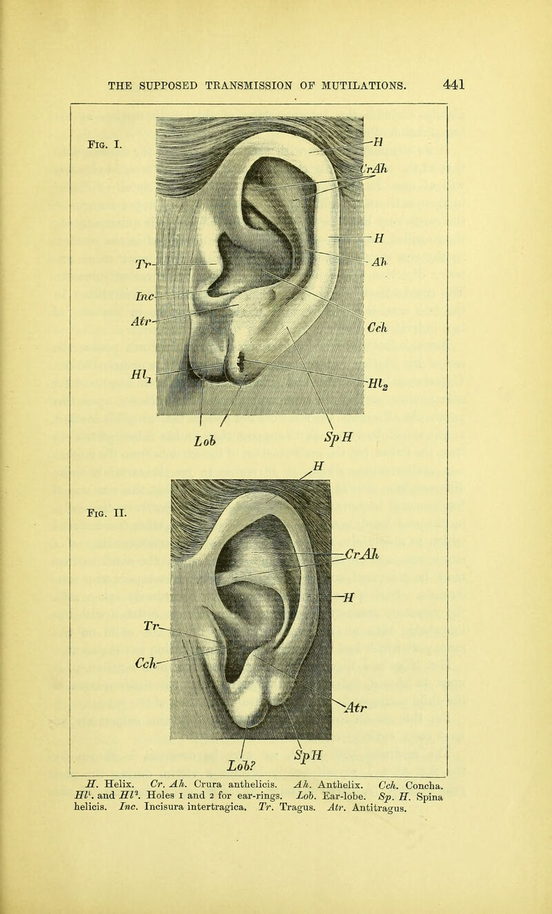 S. Helix. Cr. Ah. Crura anthelicis. Ah. Anthelix. Cch. Concha. -Z7i'. and HP. Holes l and 2 for ear-rings. Lob. Ear-lobe. 8p. H. Spina helicis. Inc. Incisura intertragica. Tr. Tragus. Atr. Antitragus.