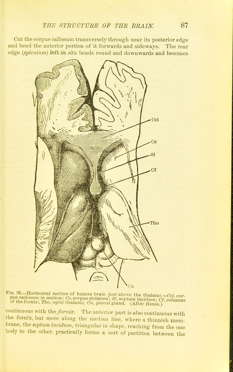 Cut the corpus callqsum transversely through near its posterior edge and bend the anterior portion of it forwards and sideways. The rear edge (spleimim) left in sitic bends round and downwards and becomes Ti section of human brain just above the thalanii —Cc/ cor- pus callosmn in section; Cs,corpus striatiiin; .57, septum luci(Uiin- Cf colnmrU of the fornix; T/io, optic thalaini; Cn, pineal gland. (Aft^i Henle.) ' ^ continuous with the fornix. Tlie anterior i)art is also continuous with the fornix, but more along the mediiiu line, where a thinnish mem- brane, the Hejytum lucidum, triangular in shape, reaching from the one body to the other, practically forms a sort of partition between the