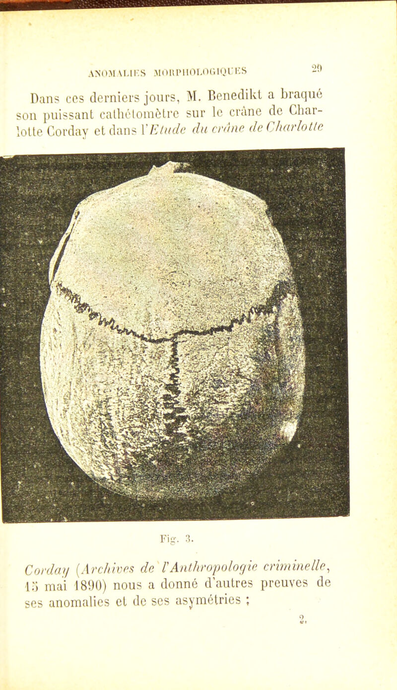 .\N().^lAr.li:S .MOllPIKn-OOIQL'KS Dans CCS derniers jours, M. Benedikt a braqué son puissant calhélomètre sur le crâne de Char- lotte Corday et dan? Y Elude du ci'ànc de Charlotte Fig. 3. Corday [Archives de TAnthropologie criminelle, 15 mai 1890) nous a donné d'autres preuves de ses anomalies et de ses asymétries ;