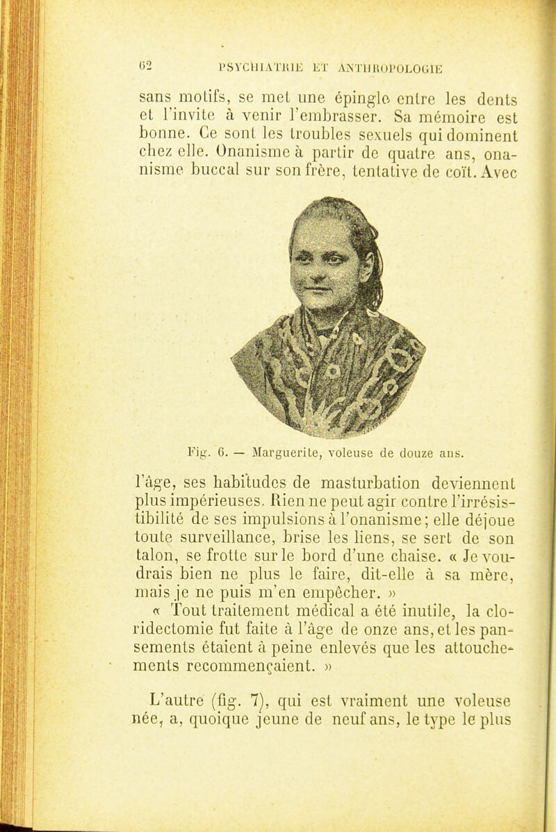 sans motifs, se met une épinglo entre les dents et l'invite à venir l'embrasser. Sa mémoire est bonne. Ce sont les troubles sexuels qui dominent chez elle. Onanisme à partir de quatre ans, ona- nisme buccal sur son frère, tentative de coït. Avec Fig. 6. — Marguerite, voleuse de douze ans. l'âge, ses habitudes de masturbation deviennent plus impérieuses. Rien ne peut agir contre l'irrésis- tibilité de ses impulsions à l'onanisme ; elle déjoue toute surveillance, brise les liens, se sert de son talon, se frotte sur le bord d'une chaise. « Je vou- drais bien ne plus le faire, dit-elle à sa mère, mais je ne puis m'en empêcher. » ot Tout traitement médical a été inutile, la clo- ridectomie fut faite à l'âge de onze ans, et les pan- sements étaient à peine enlevés que les attouche- ments recommençaient. » L'autre (fig. 7), qui est vraiment une voleuse née, a, quoique jeune de neuf ans, le type le plus