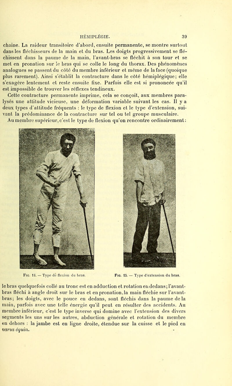 chaîne. La raideiu' transitoire d'abord, ensuite permanente, se montre surtout dans les fléchisseurs de la main et du bras. Les doigts progressivement se flé- chissent dans la paume de la main, l'avant-bras se fléchit à son tour et se met en pronation sur le bras qui se colle le long du thorax. Des phénomènes analogues se passent du côté du membre inférieur et môme de la face (quoique plus rarement). Ainsi s'établit la contracture dans le côté hémiplégique; elle s'exagère lentement et reste ensuite fixe. Parfois elle est si prononcée qu'il est impossible de trouver les réflexes tendineux. Cette contracture permanente imprime, cela se conçoit, aux membres para- lysés une attitude vicieuse, une déformation variable suivant les cas. Il y a deux types d'attitude fréquents : le type de flexion et le type d'extension, sui- vant la prédominance de la contracture sur tel ou tel groupe musculaire. Au membre supérieur, c'est le type de flexion qu'on rencontre ordinairement: Fio. il. — Type dé flexion du bras. FiG. 15. — Type d'extension du bras. le bras quelquefois collé au tronc est en adduction et rotation en dedans ; l'avant- bras fléchi à angle droit sur le bras et en pronation,la main fléchie sur l'avant- bras; les doigts, avec le pouce en dedans, sont fléchis dans la paume de la main, parfois avec une telle énergie qu'il peut en résulter des accidents. Au membre inférieur, c'est le type inverse qui domine avec l'extension des divers segments les uns sur les autres, abduction générale et rotation du mem.bre en dehors : la jambe est en ligne droite, étendue sur la cuisse et le pied en variis équin.