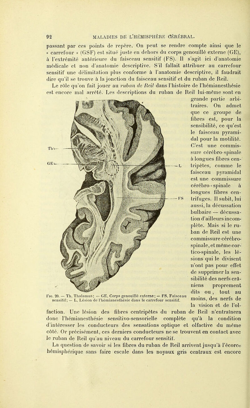 passant par ces points de repère. On peut se rendre compte ainsi que le « carrefour » (GSF) est situé juste en dehors du corps genouillé externe (GE), à l'extrémité antérieure du faisceau sensitif (FS). Il s'agit ici d'anatomie médicale et non d'anatomie desci^ptive. S'il fallait attribuer au carrefour sensitif une délimitation plus conforme à l'anatomie descriptive, il faudrait dire qu'il se trouve à la jonction du faisceau sensitif et du ruban de Reil. Le rôle qu'on fait jouer au ruban de Reil dans l'histoire de l'hémianesthésie est encore mal arrêté. Les descriptions du ruban de Reil lui-môme sont en grande partie arbi- traires. On admet que ce groupe de fibres est, pour la sensibilité, ce qu'est le faisceau pyrami- dal pour la motilité. C'est une commis- sure cérébro-spinale à longues fibres cen- tripètes, comme le faisceau pyramidal est une commissure cérébro - spinale à longues fibres cen- trifuges. Il subit, lui aussi, la décussation bulbaire — décussa- tion d'ailleurs incom- plète. Mais si le ru- ban de Reil est une commissure cérébro- spinale, et même cor- lico-spinale, les lé- sions qui le divisent n'ont pas pour effet de supprimer la sen- sibilité des nerfs crâ- niens proprement dits ou, tout au moins, des nerfs de la vision et de l'ol- faction. Une lésion des fibres centripètes du ruban de Reil n'entraînera donc l'hémianesthésie sensitivo-sensorielle complète qu'à la condition d'intéresser les conducteurs des sensations optique et olfactive du même côté. Or précisément, ces derniers conducteurs ne se trouvent en contact avec le ruban de Reil qu'au niveau du carrefour sensitif. La question de savoir si les fibres du ruban de Reil arrivent jusqu'à l'écorcc hémisphérique sans faire escale dans les noyaux gris centraux est encore G. 20. — Tli, l liiil.iiniis; — (.E, Corps genouille externe; — FS, Faisceau sensilif ; — L, Lésion de 1 iiemianeslhesie dans le carrefour sensitif.