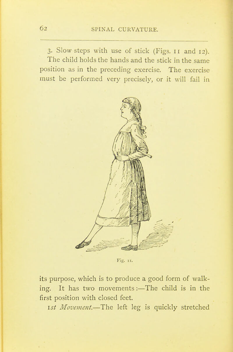 3. Slow Steps with use of stick (Figs, ii and 12). The child holds the hands and the stick in the same position as in the preceding exercise. The exercise must be performed very precisely, or it will fail in Fig. II. its purpose, which is to produce a good form of walk- ing. It has two movements :—The child is in the first position with closed feet. isi Movement.—The left leg is quickly stretched