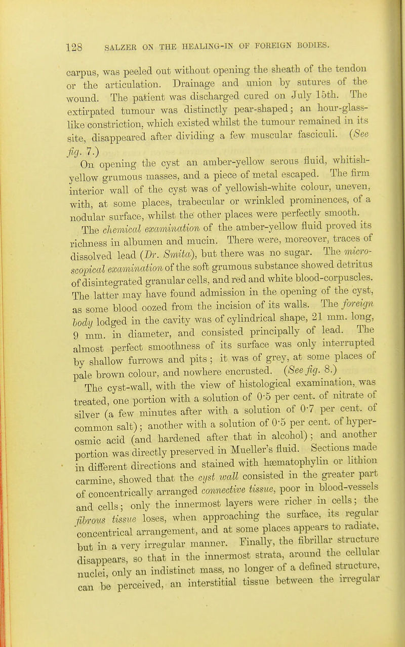 carpus, was peeled out without opening the sheath of the tendon or the articulation. Drainage and union by sutures of the wound. The patient was discharged cured on July 15th. The extirpated tumour was distinctly pear-shaped; an hour-glass- like constriction, which existed whilst the tumour remained in its site, disappeared after dividing a few muscular fasciculi. (See On opening the cyst an amber-yellow serous fluid, whitish- yellow grumous masses, and a piece of metal escaped. The firm interior wall of the cyst was of yellowish-white colour, uneven, with, at some places, trabecular or wrinkled prominences, of a nodular surface, whilst the other places were perfectly smooth.^ The chemical examination of the amber-yellow fluid proved its richness in albumen and mucin. There were, moreover, traces of dissolved lead (Br. SmUa), but there was no sugar. The mi<yro- scoincal examination o^ the soft grumous substance showed detritus of disintegrated granular cells, and red and white blood-corpuscles. The latter may have found admission in the opening of the cyst, as some blood oozed from the incision of its walls. The foreign tody lodged in the cavity was of cylindrical shape, 21 mm. long, 9 mm. in diameter, and consisted principally of lead. The almost perfect smoothness of its surface was only interrupted by shallow furrows and pits; it was of grey, at some places of pale brown colour, and nowhere encrusted. (See fig. 8.) The cyst-wall, with the view of histological examination,, was treated, one portion with a solution of 0-5 per cent, of nitrate of silver (a few minutes after with a solution of 07 per cent, of common salt); another with a solution of 0-5 per cent, of hyper- osmic acid (and hardened after that in alcohol) ; and another portion was directly preserved in Mueller's fluid. Sections made in difi-erent dii^ections and stained with h^matophylm or lithion carmine, showed that the cyst luall consisted in the greater part of concentrically arranged co7in6ctive tissue, poor m blood-vessels and cells; only the innermost layers were richer m cells; the fihrous tissue loses, when approaching the surface, its regular concentrical arrangement, and at some places appears to radiate, but in a very irregular manner. Finally, the fibrillar structure disapiDears, so that in the innermost strata, around the cellular nuclei only an indistinct mass, no longer of a defined structure, can be perceived, an interstitial tissue between the irregular