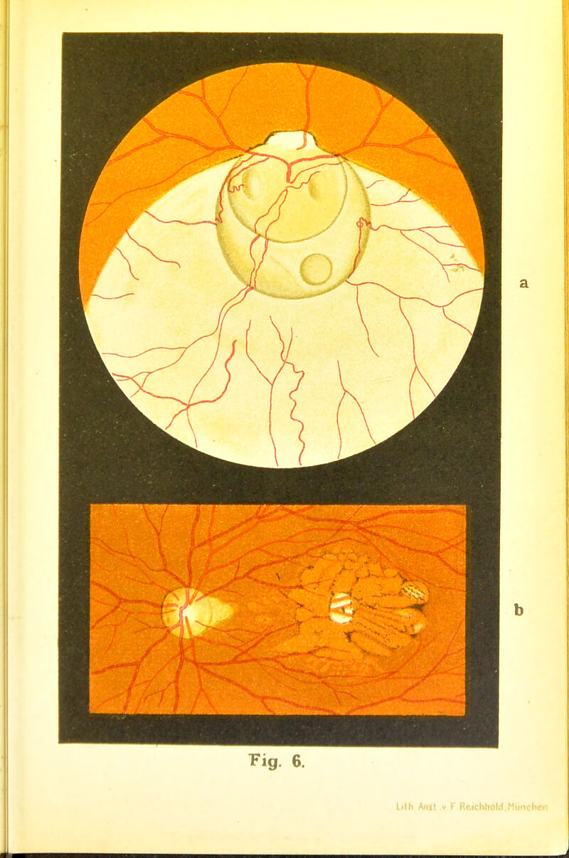 Fig. 6. Lilh Aiisl .V F Reichholrf,Hiinchi-i