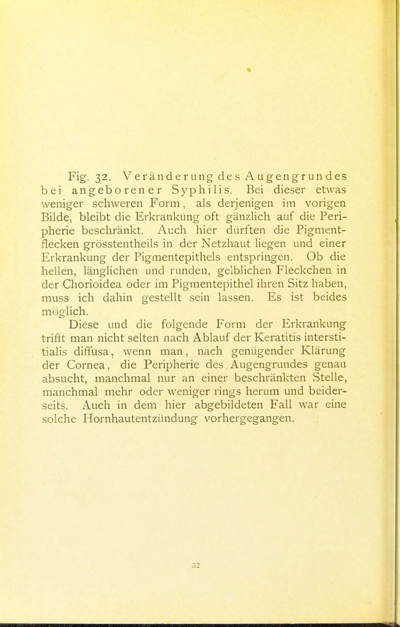 bei angeborener Syphilis. Bei dieser etwas weniger schweren Form, als derjenigen im vorigen Bilde, bleibt die Erkrankung oft gänzlich auf die Peri- pherie beschränkt. Auch hier dürften die Pigment- flecken grösstentheils in der Netzhaut liegen und einer Erkrankung der Pigmentepithels entspringen. Ob die hellen, länglichen und runden, gelblichen Fleckchen in der Chorioidea oder im Pigmentepithel ihren Sitz haben, muss ich dahin gestellt sein lassen. Es ist beides möglich. Diese und die folgende Form der Erkrankung trifft man nicht selten nach Ablauf der Keratitis intersti- tialis diffusa, wenn man, nach genügender Klärung der Cornea, die Peripherie des Augengrundes genau absucht, manchmal nur an einer beschränkten Stelle, manchmal mehr oder weniger rings herum und beider- seits. Auch in dem hier abgebildeten Fall war eine solche Hornhautentzündung vorhergegangen.