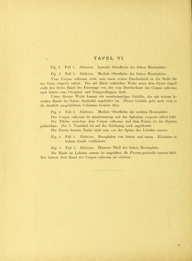 Fig. 1. Fall 1. Blödsinn. Laterale Oberfläche der linkeu Hemisphäre. Fig. 2. Fall 1. Blödsinn. Mediale Oberfläche der linken Hemisphäre. Vom Corpus callosum sieht man einen ovalen Durchschnitt an der Stelle für das Genu corpoi'is callosi. Der mit Rinde bekleidete Wulst unter dem Gyrus ciuguli stellt den freien Rand des Faserzugs vor, der vom Durchschnitt des Corpus callosum nach hinten zum Occipital- und Temporallappen läuft. Unter diesem Wulst kommt ein membranartiges Gebilde, das mit seinem la- teralen Rande im Sulcus chorioidei angeheftet ist. Dieses Gebilde geht nach vorn in die deutlich ausgebildeten Columnae fornicis über. Fig. 3. Fall 2. Blödsinn. Mediale Oberfläche der rechten Hemisphäre. Das Corpus callosum ist membranartig und das Splenium corporis callosi fehlt. Die Fläche zwischen dem Corpus callosum und dem Fornix ist das Septuni pellucidum. Der 5. Ventrikel ist auf der Zeichnung auch angedeutet. Die Fascia dentata Tarini sieht man vor der Spitze des Lobulus cuneus. Fig. 4. Fall 1. Blödsinn. Encephalon von hinten und unten. Kleinhirn in hohem Grade verkleinert. Fig. 5. Fall 2. Blödsinn. Hinterer Theil der linken Hemisphäre. Die Rinde im Lobulus cuneus ist ungefaltet, die Fissura parietalis interna fehlt. Der hintere freie Rand des Corpus callosum ist sichtbar.