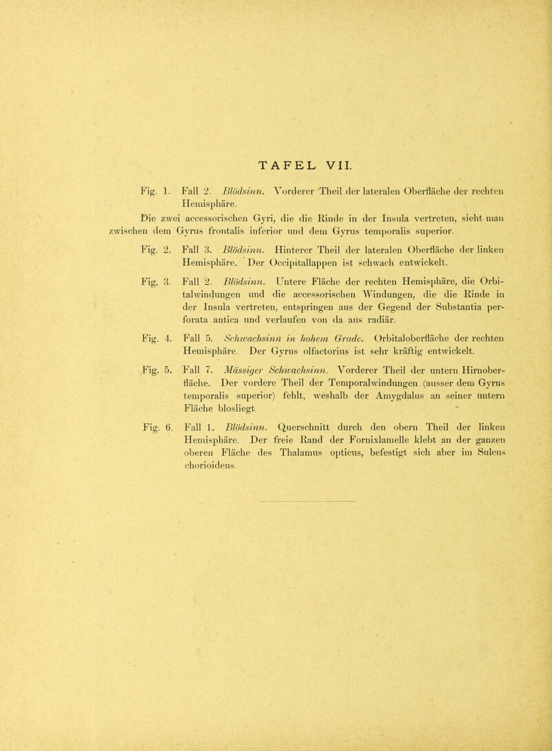 Fig. 1. Fall 2. Blödsinn. Vorderer Theil der lateralen Oberfläche dei-rechten Hemisphäre. Die zwei accessorischen Gyri, die die Rinde in der Insula vertreten, sieht man zwischen dem Gyrus frontalis inferior und dem Gyrus temporalis superior. Fig. 2. Fall 3. Blödsinn. Hinterer Theil der lateralen Oberfläche der linken Hemisphäre. Der Occipitallappen ist schwach entwickelt. Fig. 3. Fall 2. Blödsinn. Untere Fläche der rechten Hemisphäre, die Orbi- talwindungen und die accessorischen Windungen, die die Rinde in der Insula vertreteuj entspringen aus der Gegend der Substantia per- forata antica und verlaufen von da aus radiär. Fig. 4. Fall 5. Schivachsinn in hohem Grade. Orbitaloberfläche der rechten Hemisphäre. Der Gyrus olfactorius ist sehr kräftig entwickelt. Fig. 5. Fall 7. Massiger Schivachsinn. Vorderer Theil der untern Hiruober- fläche. Der vordere Theil der Teraporalwindungen (ausser dem Gyrus temporalis superior) fehlt, weshalb der Amygdalus an seiner untern Fläche blosliegt. Fig. 6. Fall 1. Blödsinn. Querschnitt durch den obern Theil der linken Hemisphäre. Der freie Rand der Fornixlaraelle klebt an der ganzen oberen Fläche des Thalamus opticus, befestigt sich aber im Sulcus chorioideus.