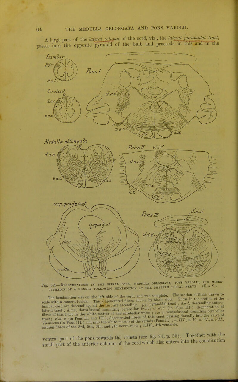 A IdV're part of the Jatei-al column of the cord, viz., the laM pyramidal tract, passes iuto the opposite pyramid of the bulb aud proceeds in tliis and in the Fie- 52.-DEGENBRATIOKS IN TBK SPINAL CORB, MEDULLA OBLONGATA, PONS VAROLII, ^ND MESEN- CEPHALON OF A MONKEY FOLLOWING HEMISECTION AT THE TWELFTH DOESAL NER^E. (li.A.b.) The hemisection was on the left side of the cord, and was -^f^*- /^^^ -^^^^^^^^^ scale with a camera lucida. The degenerated fibres shown by black dots .^^7/™ X^an^ Yieussens (in Pons III.) and into the white matter of the vermis (J°s II. n. I ., 7., issuing fibres of the 3rd, 5th, 6th, and 7th nerve-roots ; v.IV., 4th ventiicie. ventral part of the pons towards the crnsta (see fig. 24, p. 30). Together with the smTu part of the anterior cohmn of the cord which also enters into the constitution