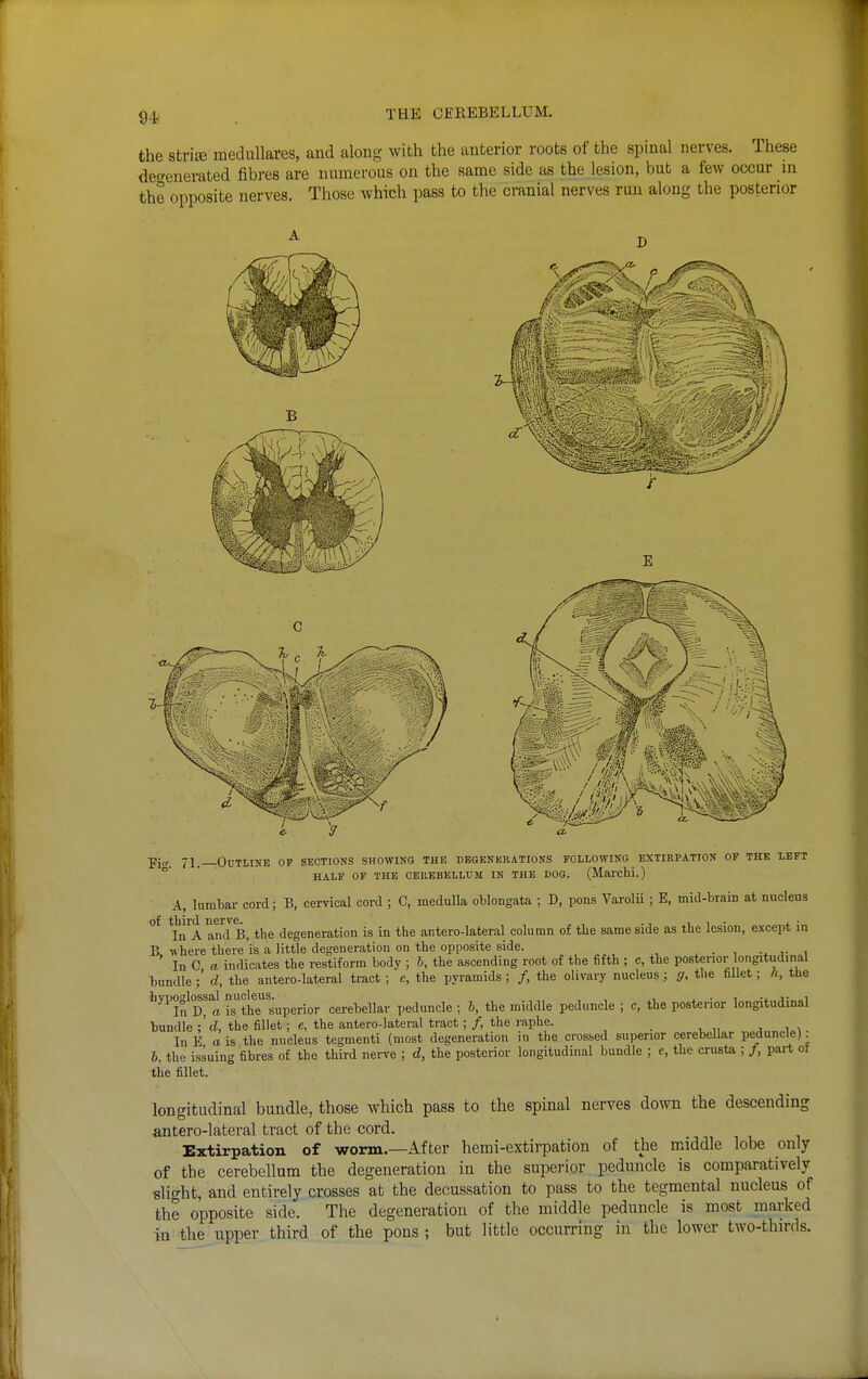 the striffi medullares, and alouR- with the anterior rootB of the spinal nerves. These deo-enerated fibres are numerous on the same side as the lesion, but a few occur in the opposite nerves. Those which pass to the cranial nerves run along the posterior E Pier. 71._0dtline op sections showing the degenerations following extirpation of the left °' ' HALF of the cerebellum IN THE DOG. (Marchi.) A, lumbar cord; B, cervical cord ; C, medulla oblongata ; D, pons Varolii ; E, mid-brain at nucleus of tbiril ii6rvG. • • In A and B, the degeneration is in the antero-lateral column of the same side as the lesion, except in B where there is a little degeneration on the opposite side. , . , •. j- i ' In C a indicates the restiform body ; 6, the ascending root of the fifth ; c, the posterior longitudinal bundle ;' d, the antero-lateral tract ; c, the pyramids ; /, the olivary nucleus ; g, tlie faUet; li, the hypoglo^sa^ i'sthel'uperior cerebellar peduncle ; h, the middle peduncle ; c, the posterior longitudinal bundle the fillet; c, the antero-lateral tract; /, the raphe. _ , , x InE a is the nucleus tegmenti (most degeneration in the crossed superior cerebellar peduncle): 6, the issuing fibres of the third nerve ; d, the posterior longitudinal bundle ; c, the crusta ; /, part ot the fillet. longitudinal bundle, those which pass to the spinal nerves down the descending ^intero-lateral tract of the cord. Extirpation of worm.—After hemi-extirpation of the middle lobe only of the cerebellum the degeneration in the superior peduncle is comparatively slight, and entirely crosses at the decussation to pass to the tegmental nucleus of the opposite side. The degeneration of the middle peduncle is most marked in the upper third of the pons ; but little occurring in the lower two-thirds.