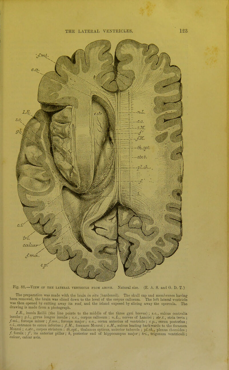 Fig. 88.—View of the latekal venteiole from above. Natural size. (E. A. S. and Gt. D. T.) The preparation was made with the brain in situ (hardened). The skull cap and membranes having been removed, the br.ain was sliced down to the level of the corpus callosum. The left lateral ventricle wa.s then opened by cutting away its roof, and the island exposed by slicing away the opercula. The drawing is made from a photograph. I.H., insula Reilii (the line points to the middle of the three gyri breves); s.c, sulcus centralis insulte; ff.L, gyrus longus insula) ; e.c, corpus callosum ; n.L., nerves of Lauci.si ; atr.t, stria (ecta ; f.mi., forceps minor ; f.ma., forceps major; c.a., cornu anterius of ventricle; c.p., cornu posterius; entrance to cornu infcrius ; f.M., foramen Monroi ; s.M., sulcus leading backwards to the foramen Monroi ; c.str., cor])us striatum ; th.opt., thalamus opticus, anterior tubercle ; jil.ch., plexus clioroides ; /, fornix; /', its anterior pillar; h, posterior end of hippocampus major; tri., trigonura ventriculi j calcar, calcar avis. \