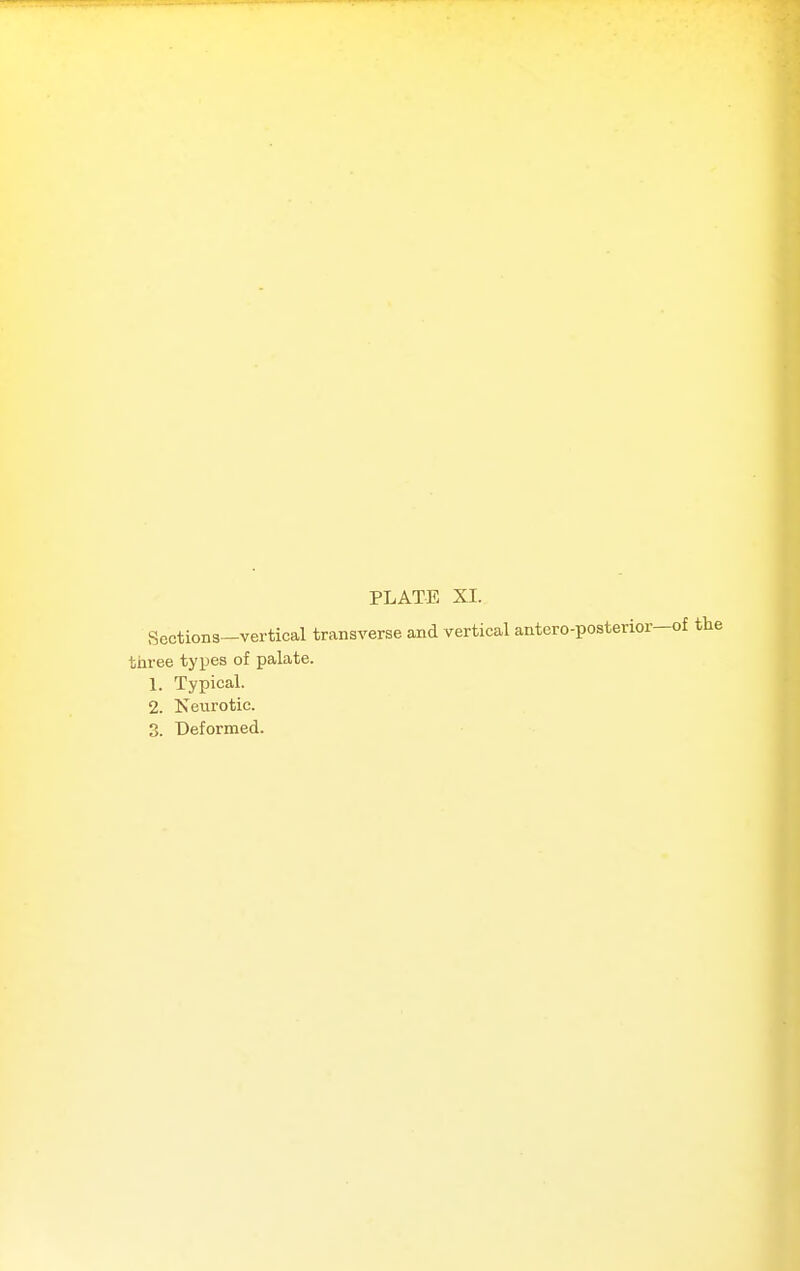Sections—vertical transverse and vertical antero-posteri three types of palate. 1. Typical. 2. Neurotic.