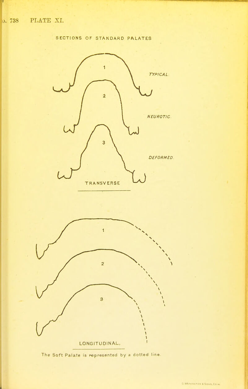 SECTIONS OF STANDARD PALATES LONGITUDINAL. The Soft Palate is represnnted by a dotted line