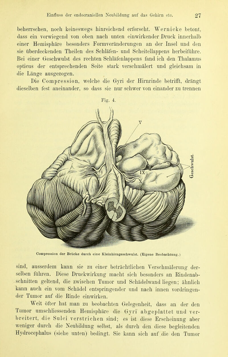 beherrschen, noch keineswegs hinreichend erforscht. Wernicke betont, dass ein vorwiegend von oben nach unten einwirkender Druck innerhalb einer Hemisphäre besonders Formveränderungen an der Insel und den sie überdeckenden Theilen des Schläfen- und Scheitellappens herbeiführe. Bei einer Geschwulst des rechten Schläfenlappens fand ich den Thalamus opticus der entsprechenden Seite stark verschmälert und gleichsam in die Länge ausgezogen. Die Compression, welche die Gyri der Hirnrinde betrifft, drängt dieselben fest aneinander, so dass sie nur schwer von einander zu trennen Fig. 4. Compression der Brücke durch eine Kleinhirngeschwulst. (Eigene Beobachtung.) sind, ausserdem kann sie zu einer beträchtlichen Versehmälerung der- selben führen. Diese Druckwirkung macht sich besonders an Eindenab- .schnitten geltend, die zwischen Tumor und Schädelwand liegen; ähnlich kann auch ein vom Schädel entspringender und nach innen vordringen- der Tumor auf die Einde einwirken. Weit öfter hat man zu beobachten Gelegenheit, dass an der den Tumor umschliessenden Hemisphäre die Gyri' abgeplattet und ver- breitert, die Sulci verstrichen sind; es ist diese Erscheinung aber weniger durch die Neubildung selbst, als durch den diese begleitenden Hydrocephalus (siehe unten) bedingt. Sie kann sich auf die den Tumor