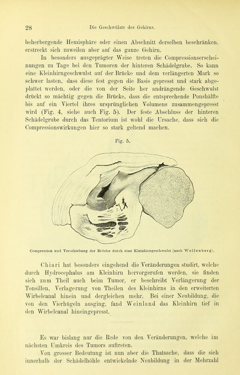 beherbergende Hemisphäre oder einen Abschnitt derselben beschränken, erstreckt sich zuweilen aber auf das ganze Gehirn. In besonders ausgeprägter Weise treten die Compressionserschei- nungen zu Tage bei den Tumoren der hinteren Schädelgrube. So kann eine Kleinhirngeschwulst auf der Brücke und dem verlängerten Mark so schwer lasten, dass diese fest gegen die Basis gepresst und stark abge- plattet werden, oder die von der Seite her andrängende Geschwulst drückt so mächtig gegen die Brücke, dass die entsprechende Ponshälfte bis auf ein Viertel ihres ursprünglichen Volumens zusamraengepresst wird (Fig. 4, siehe auch Fig. 5). Der feste Abschluss der hinteren Schädelgrube durch das Tentorium ist wohl die Ursache, dass sich die Compressionswirkungen hier so stark geltend machen. Compression und Verschiebung der Brücke durch eine Kleinhirngeschwulst (nach Wollenberg). Chiari hat besonders eingehend die Veränderungen studirt, welche durch Hydrocephalus am Kleinhirn hervorgerufen werden, sie finden sich zum Theil auch beim Tumor, er beschreibt Verlängerung der Tonsillen, Verlagerung von Theilen des Kleinhirns in den erweiterten Wirbelcanal hinein und dergleichen mehr. Bei einer Neu))ildung, die von den Vierhügeln ausging, fand Weinland das Kleinhirn tief in den Wirbelcanal hineingepresst. Es war bislang nur die Eede von den Veränderungen, welche im nächsten Umkreis des Tumors auftreten. Von grosser Bedeutung ist nun aber die Thatsache, dass die sich innerhalb der Schädelböhle entwickelnde Neubildung in der Mehrzahl Fig. 5. / l /